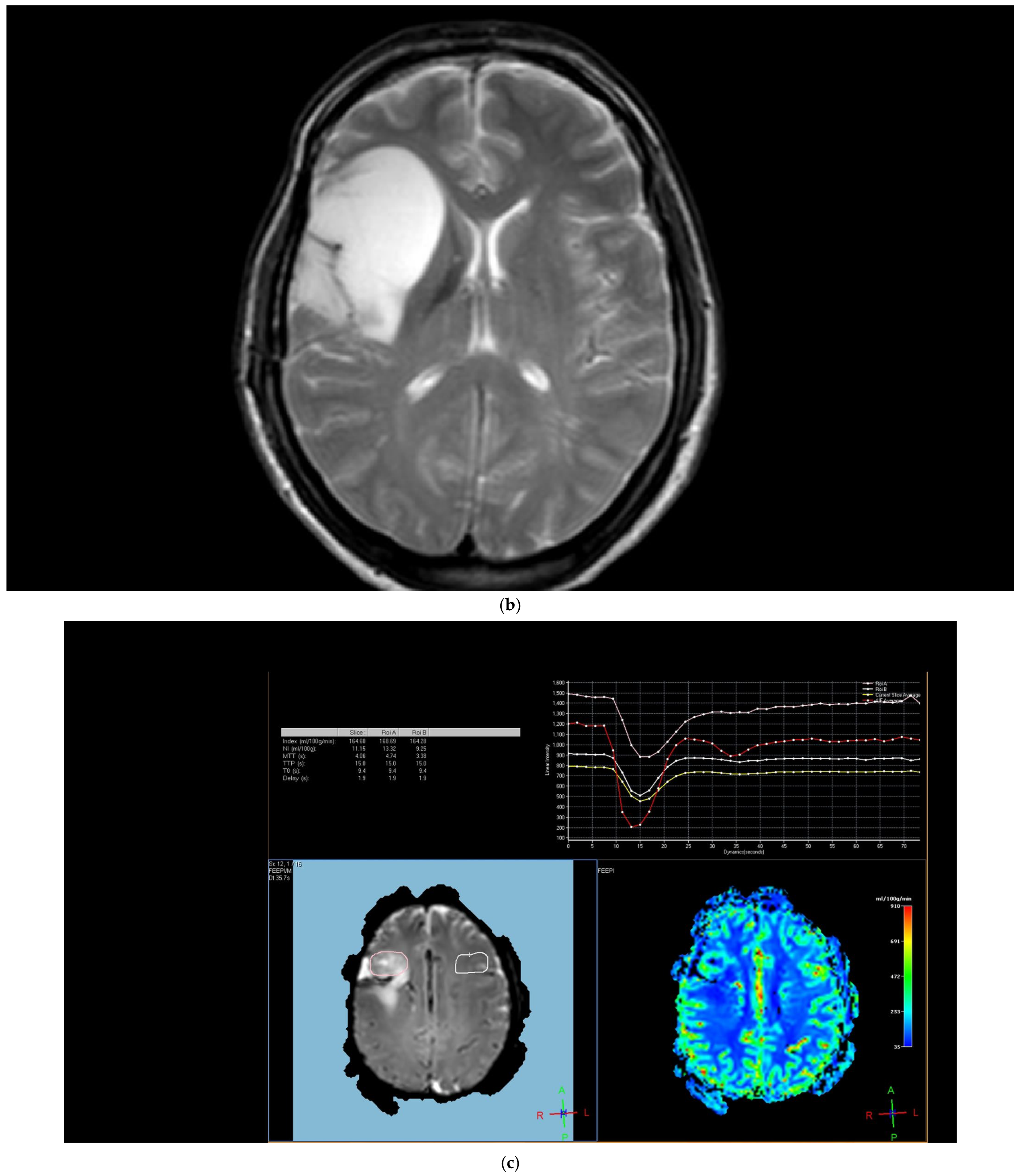 Diagnostics 15 01324 g003b