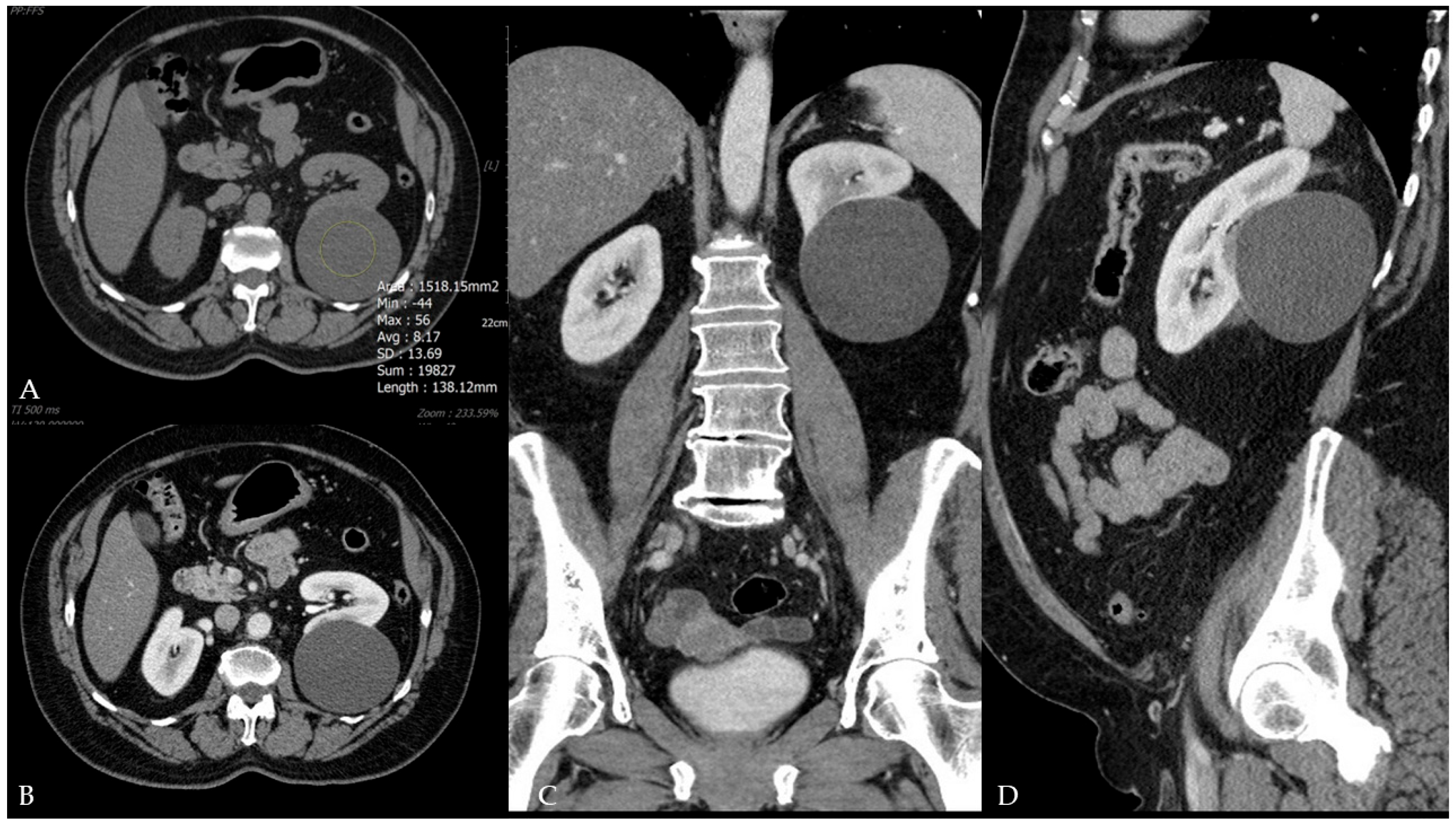 Diagnostics 15 01326 g002