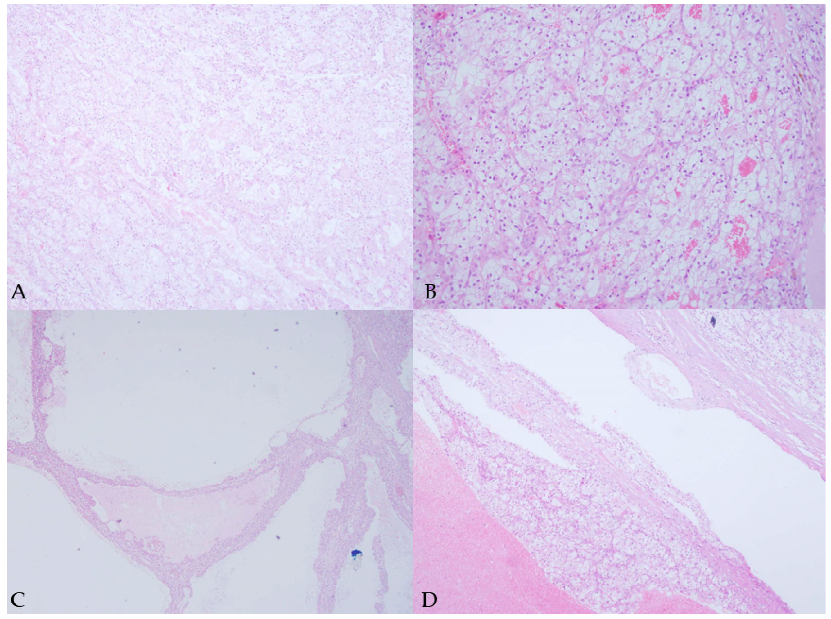 Diagnostics 15 01326 g003