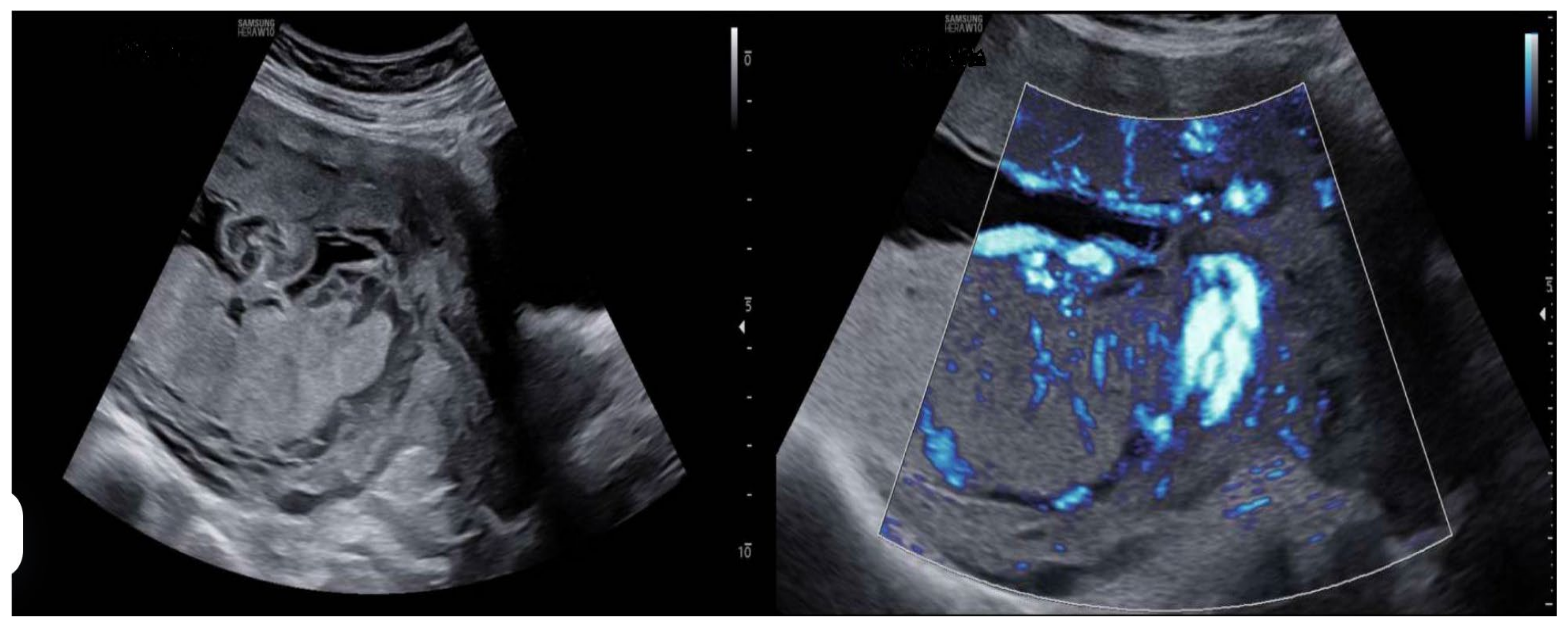 Diagnostics 15 01329 g001