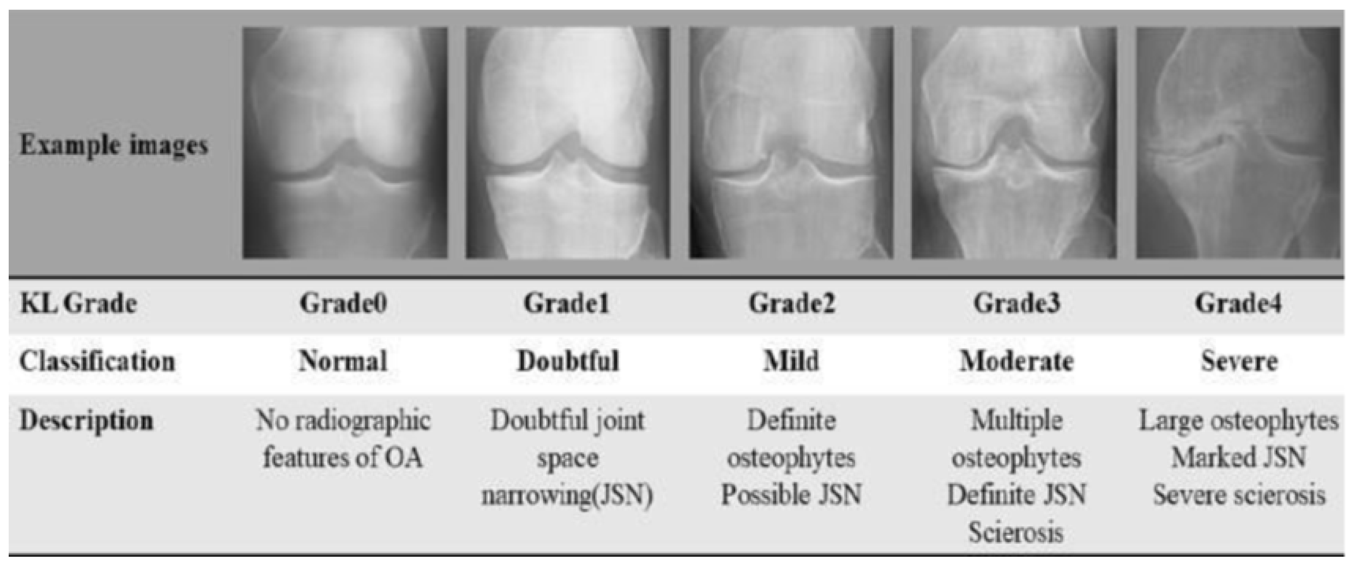 Diagnostics 15 01332 g001