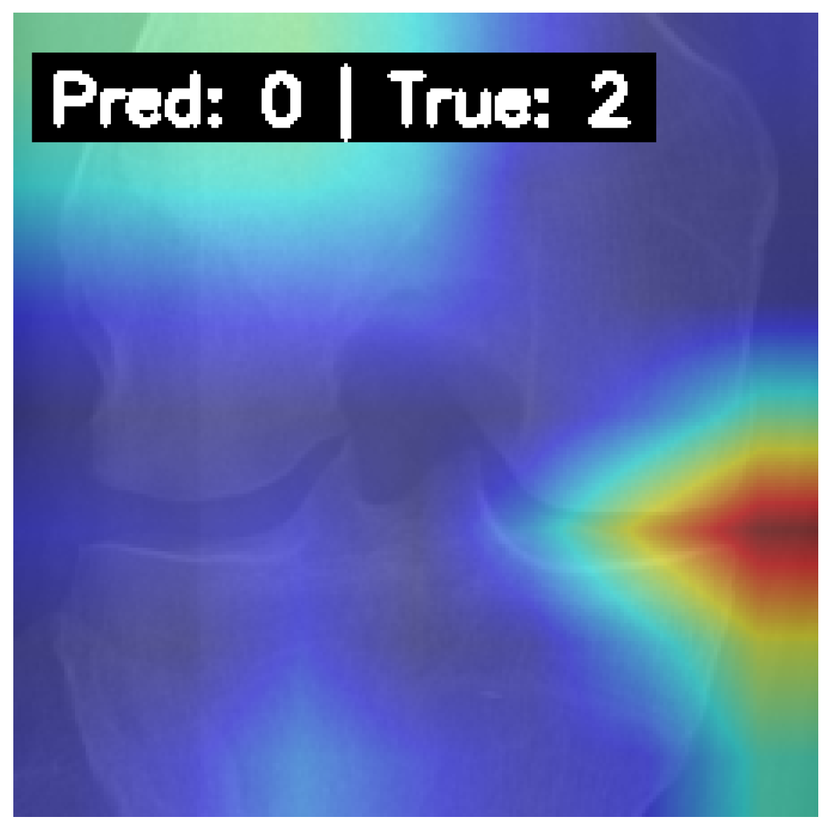 Diagnostics 15 01332 g012