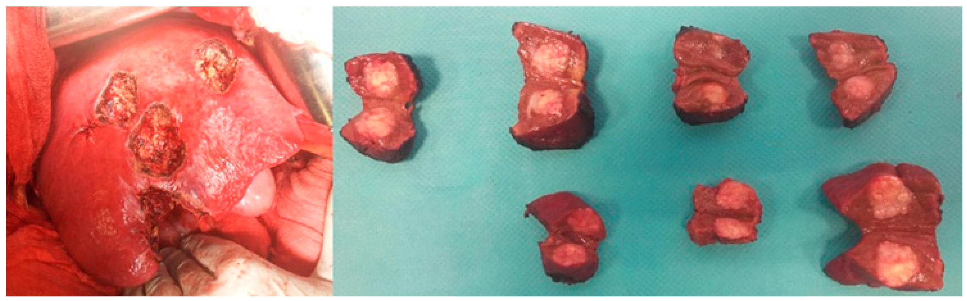 Diagnostics 15 01334 g004