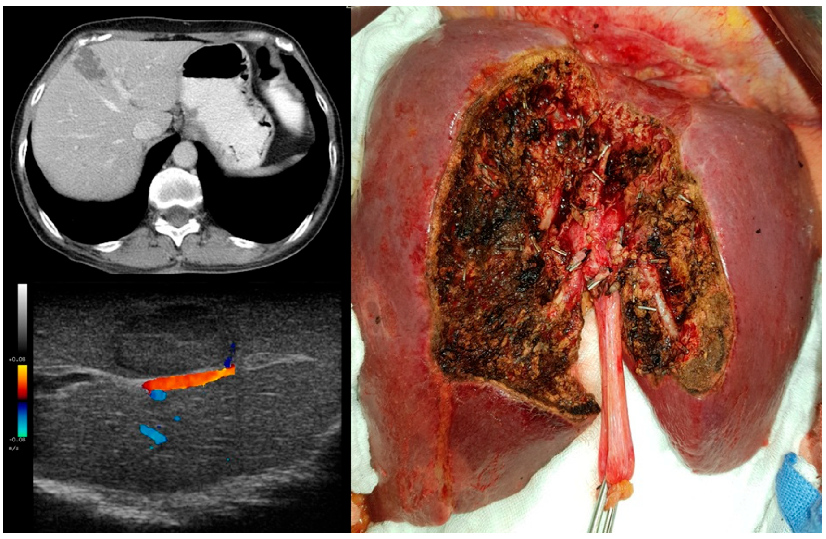 Diagnostics 15 01334 g005