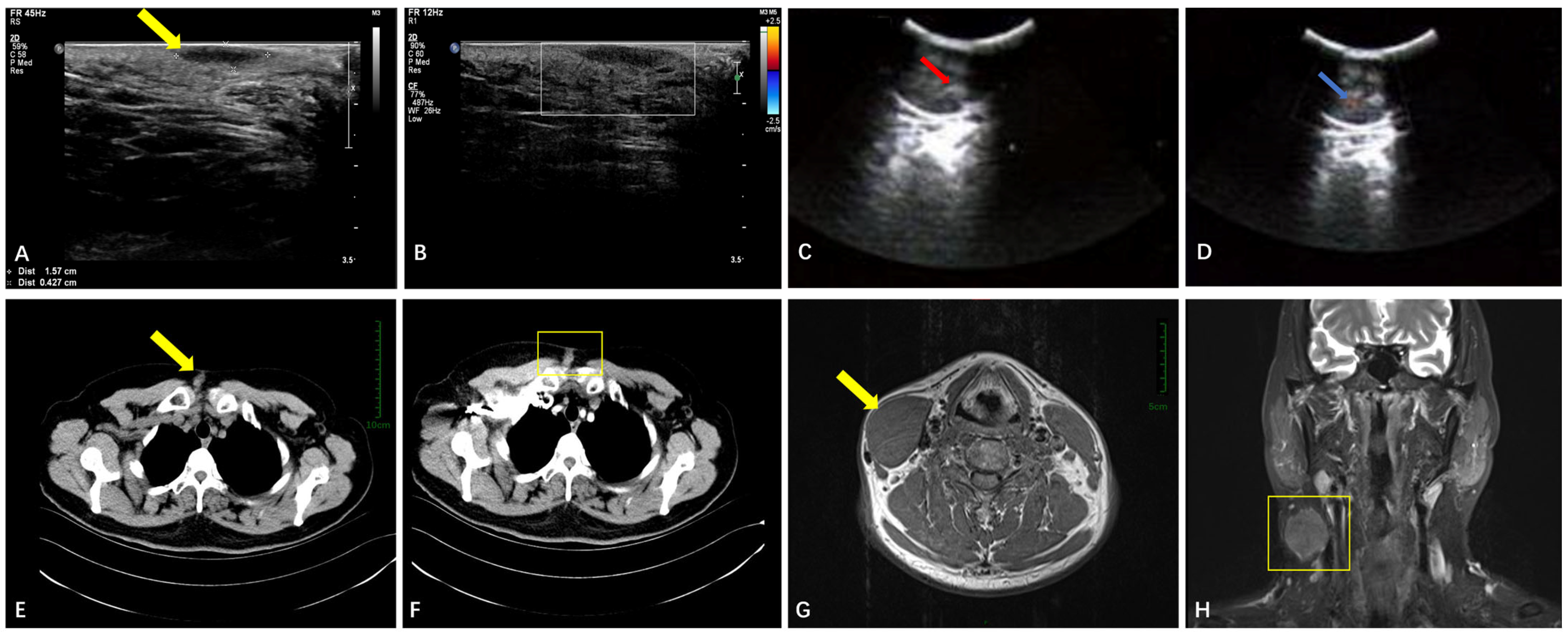 Diagnostics 15 01336 g001