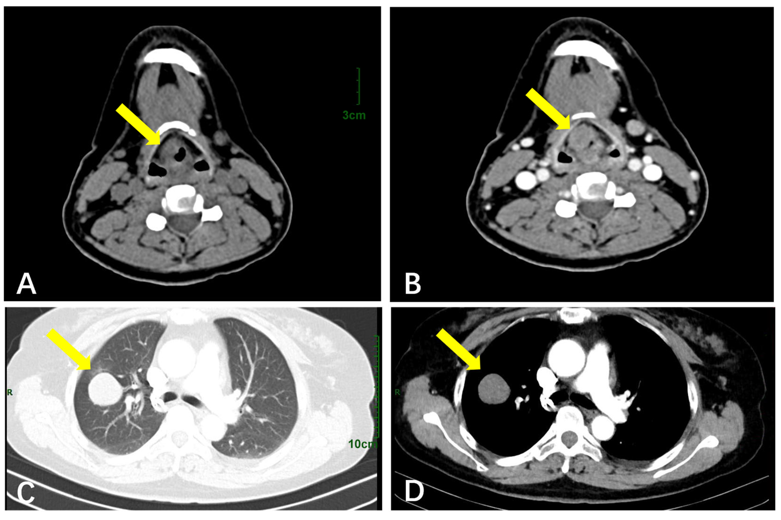 Diagnostics 15 01336 g003