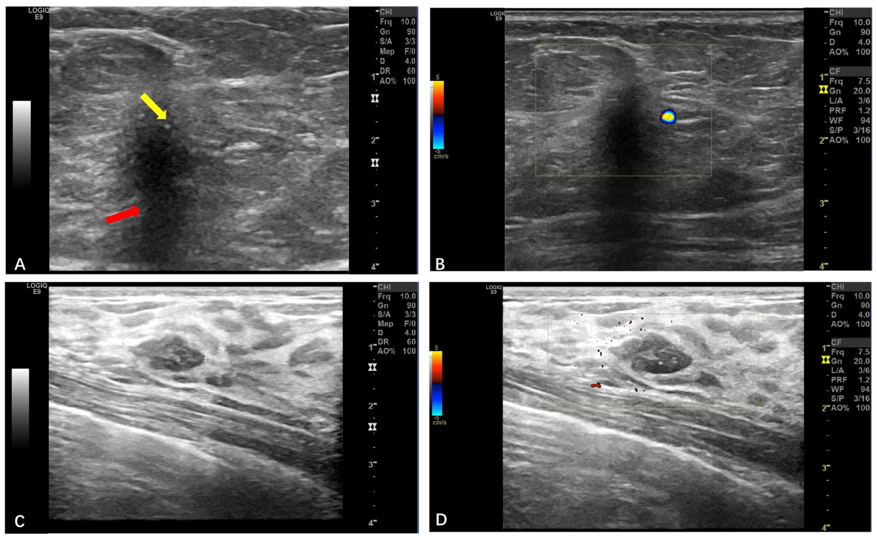 Diagnostics 15 01336 g004