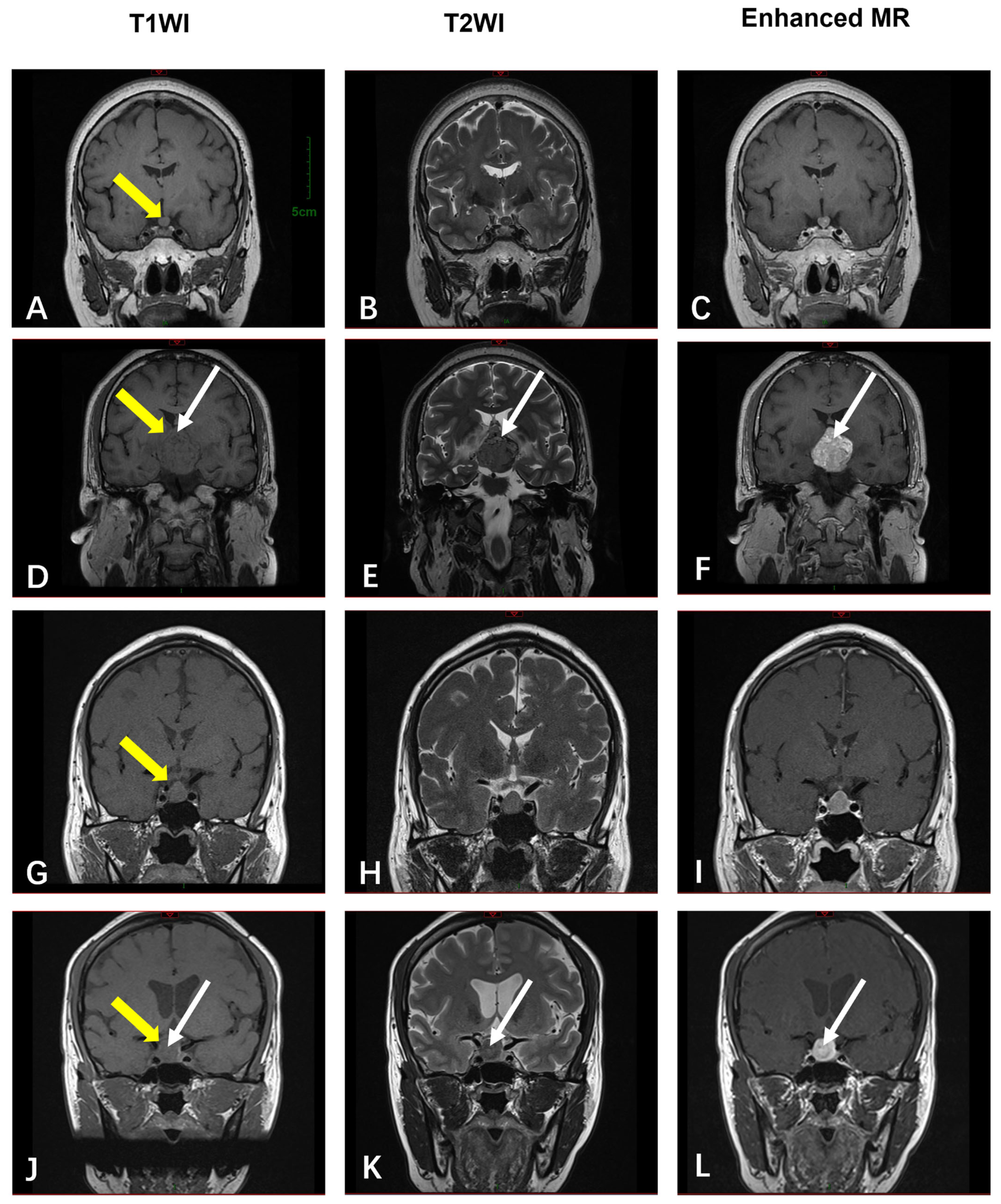Diagnostics 15 01336 g005