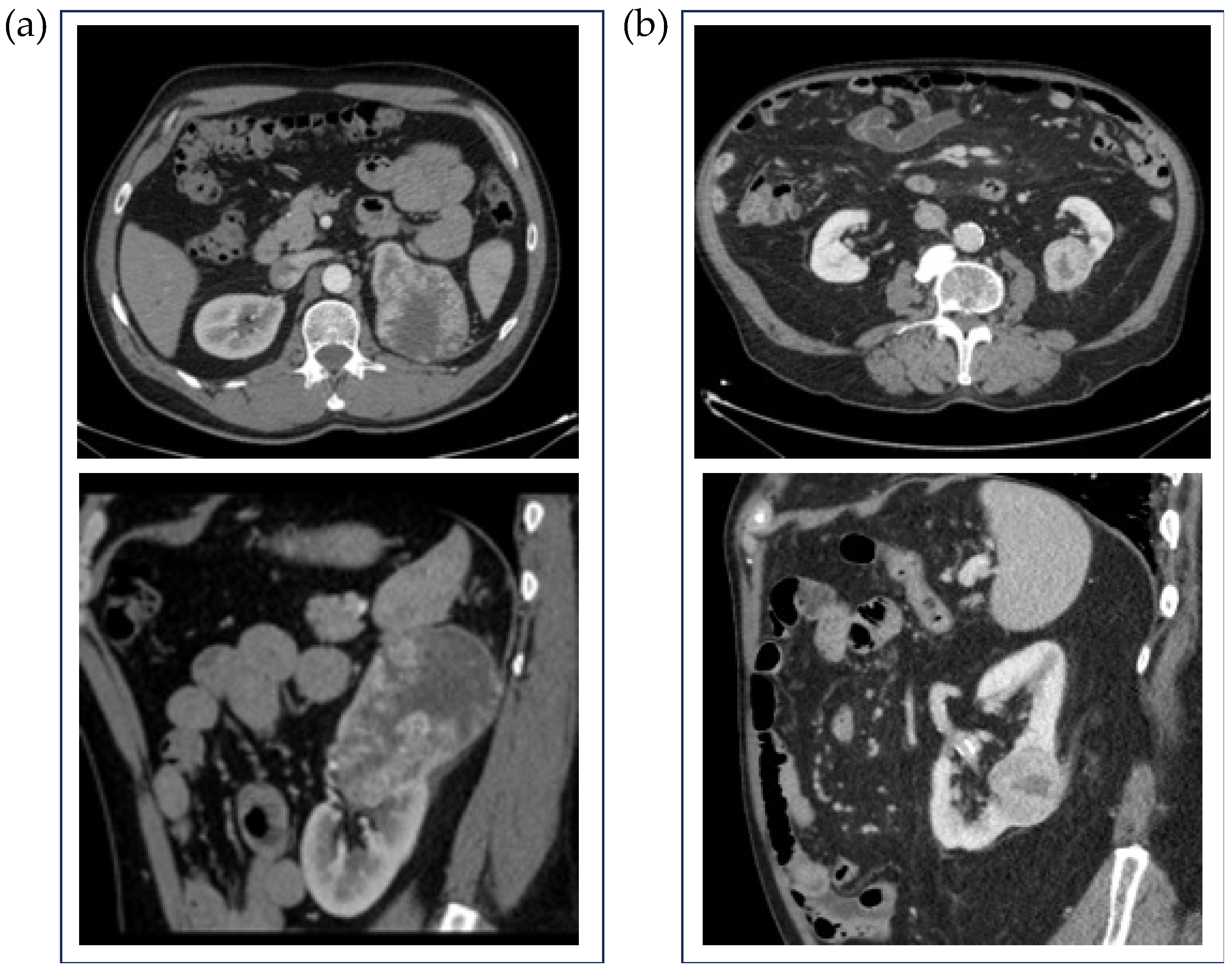 Diagnostics 15 01337 g001
