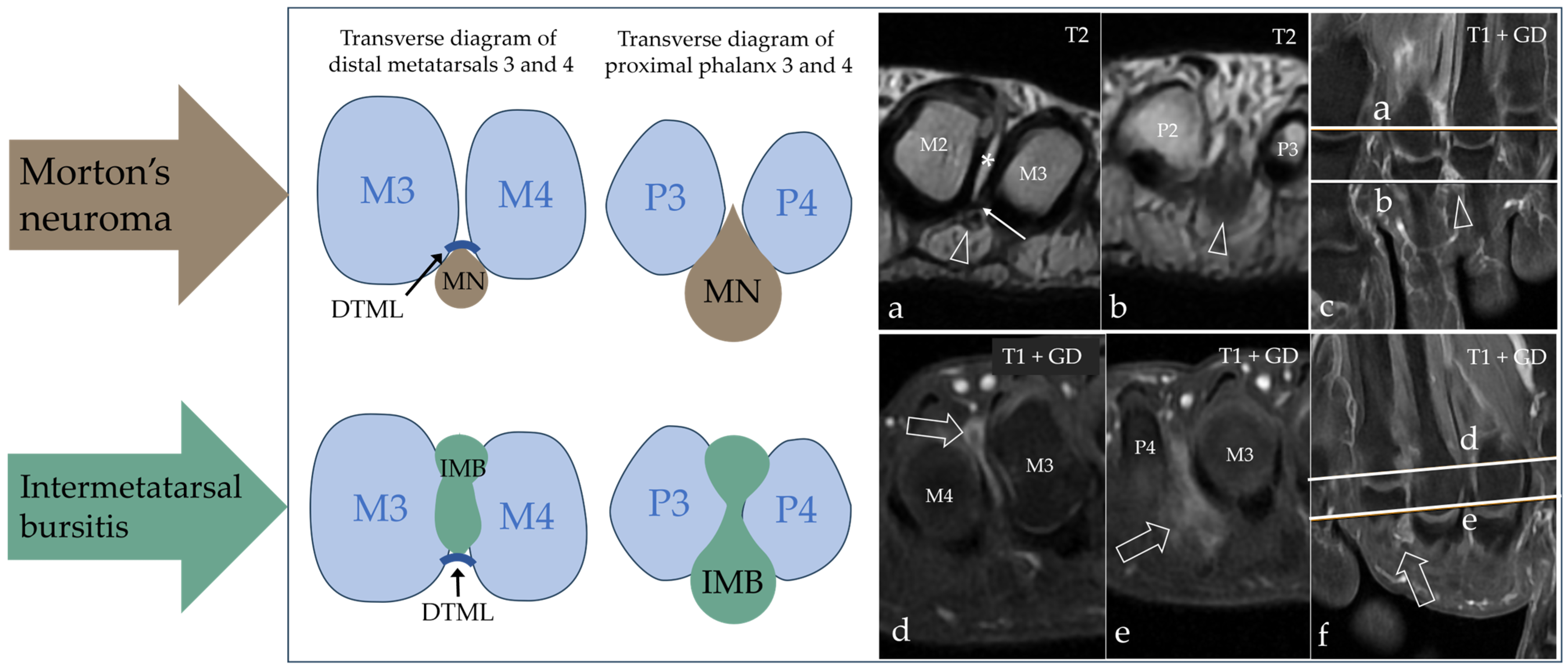 Diagnostics 15 01339 g003