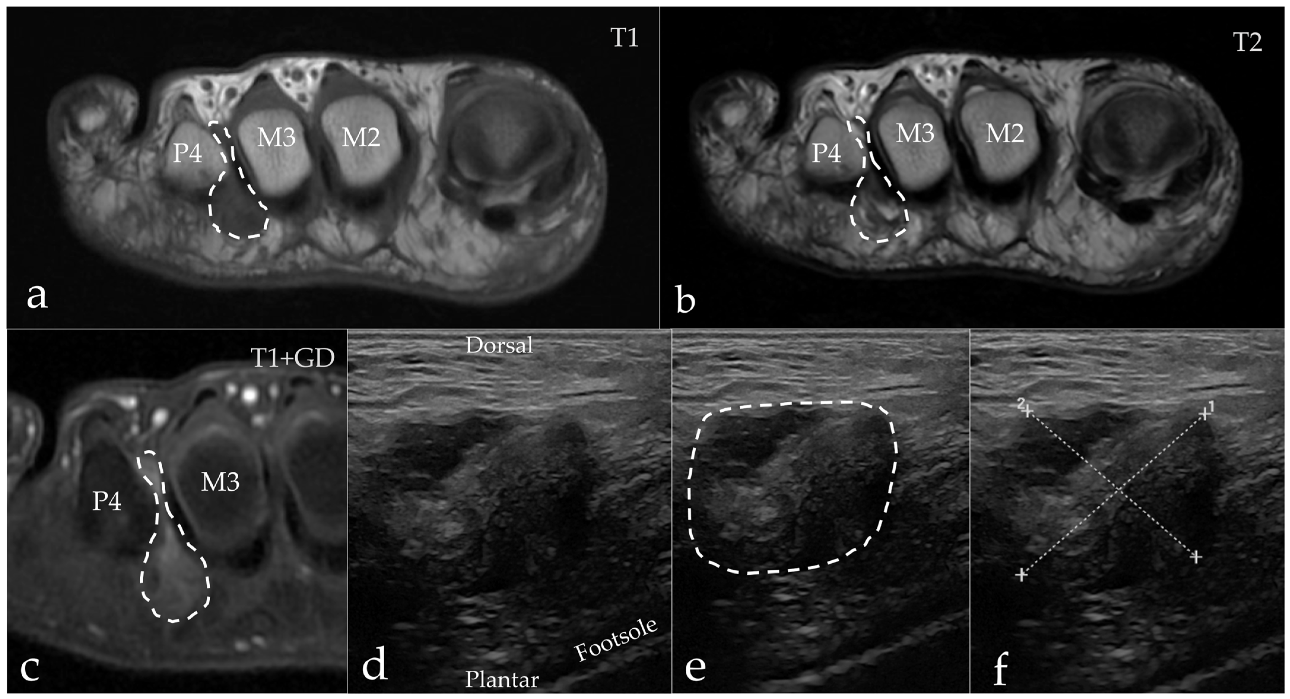 Diagnostics 15 01339 g005