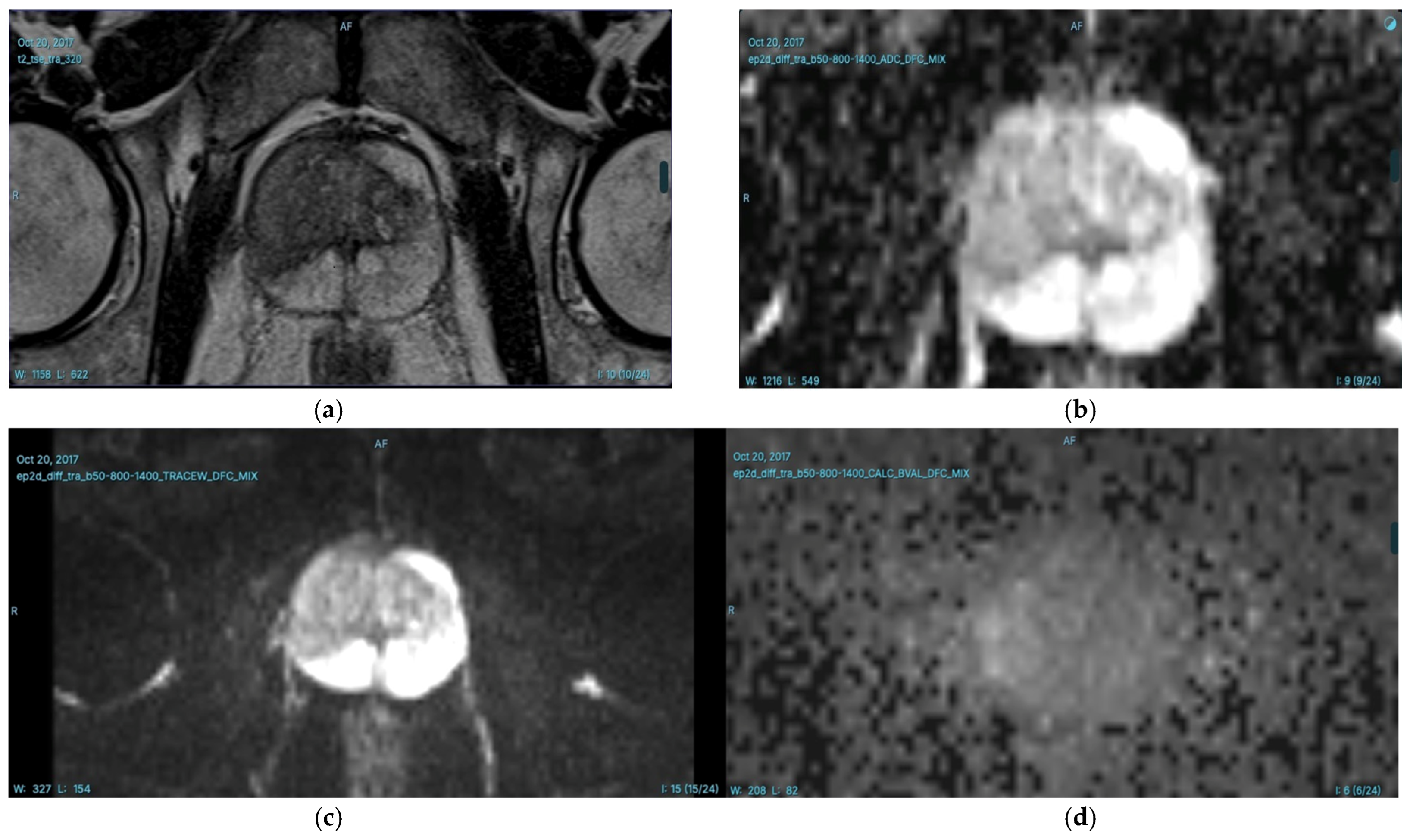 Diagnostics 15 01342 g003