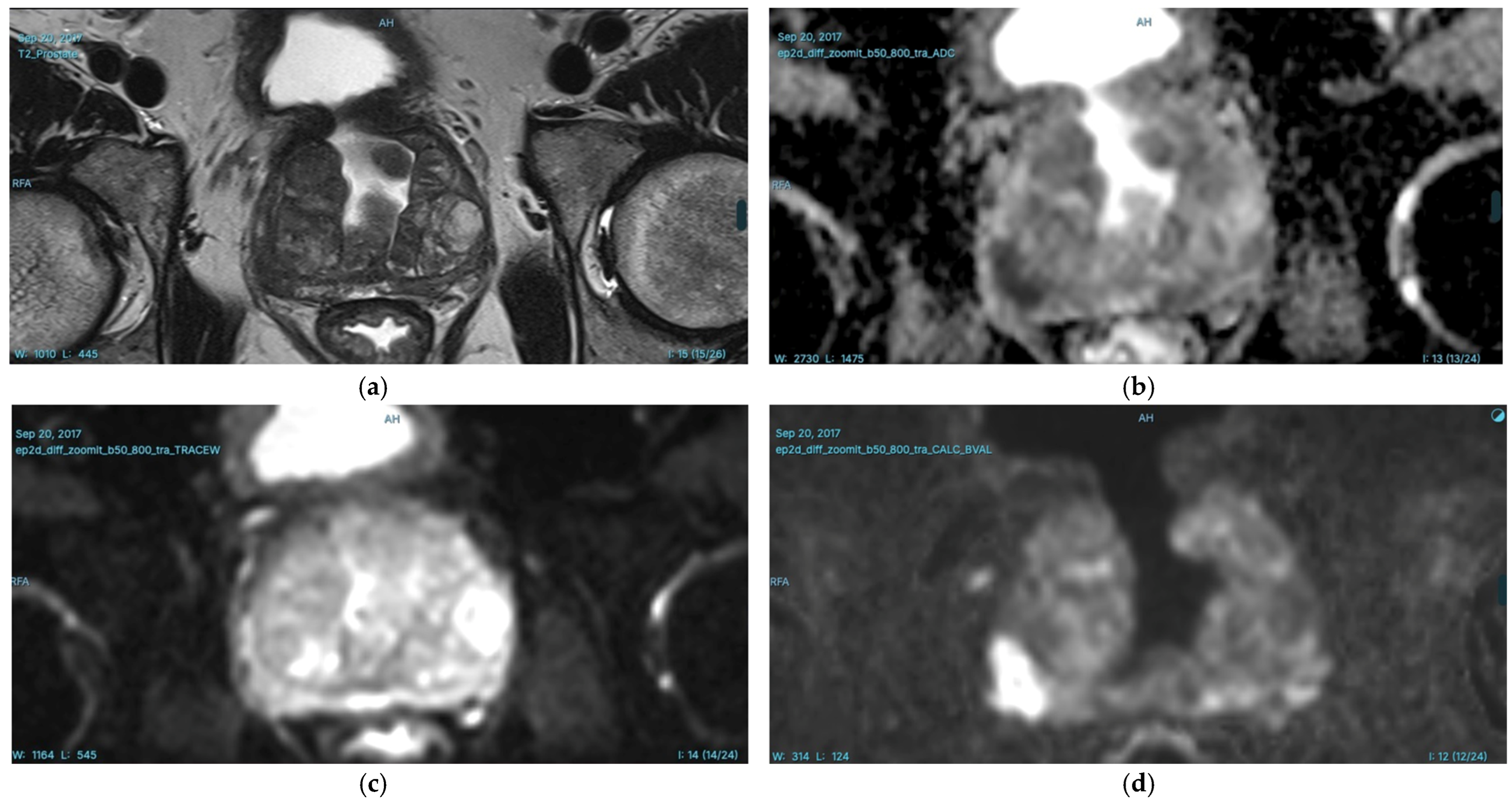Diagnostics 15 01342 g005