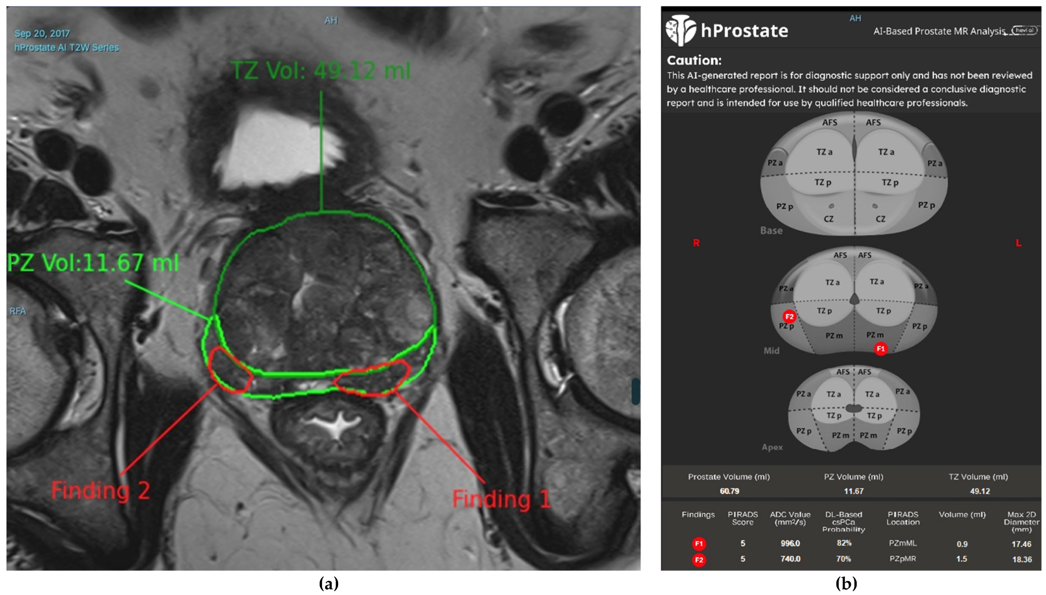 Diagnostics 15 01342 g006