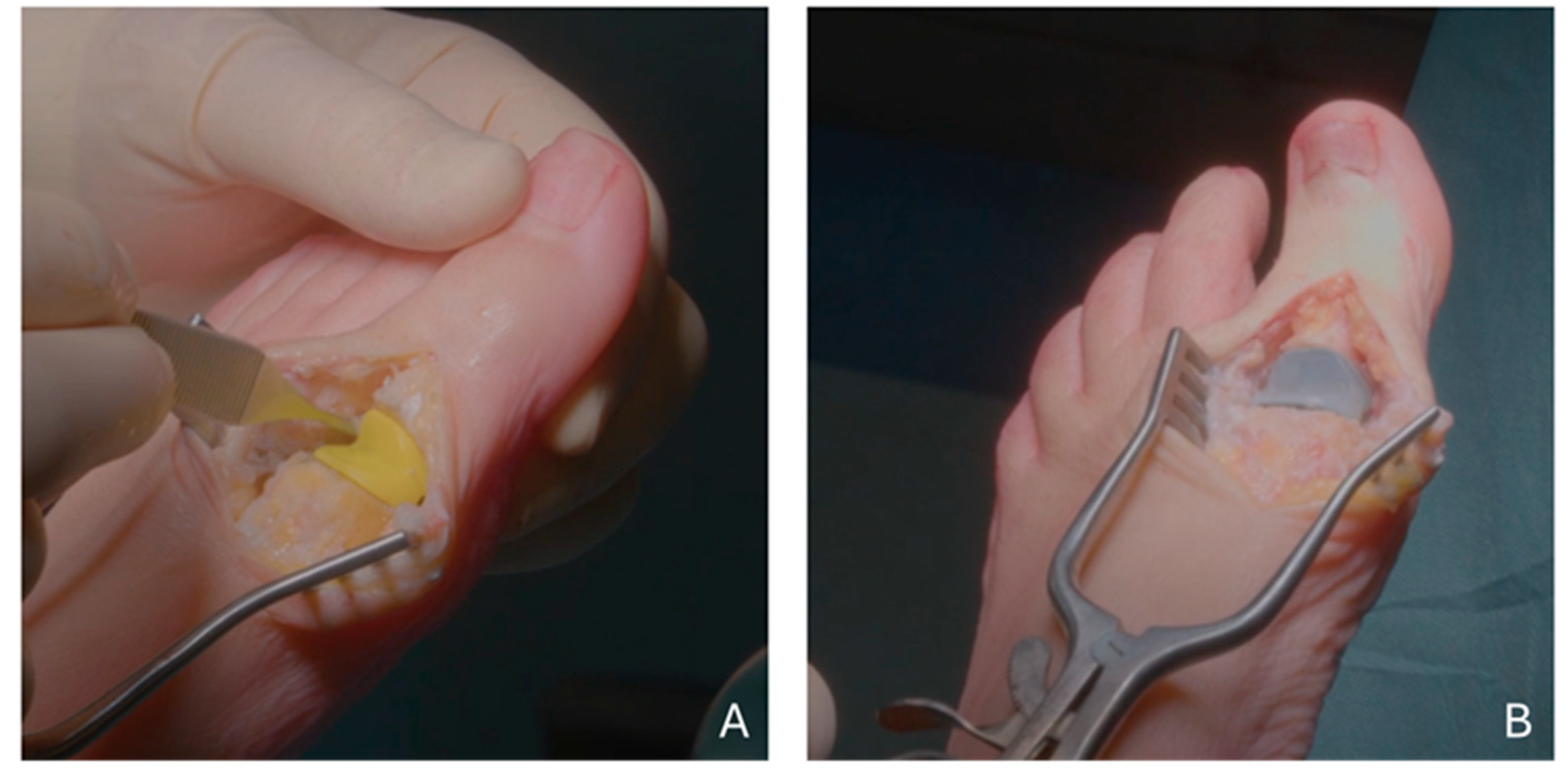 Diagnostics 15 01349 g001 Diagnostics 15 01349 g001