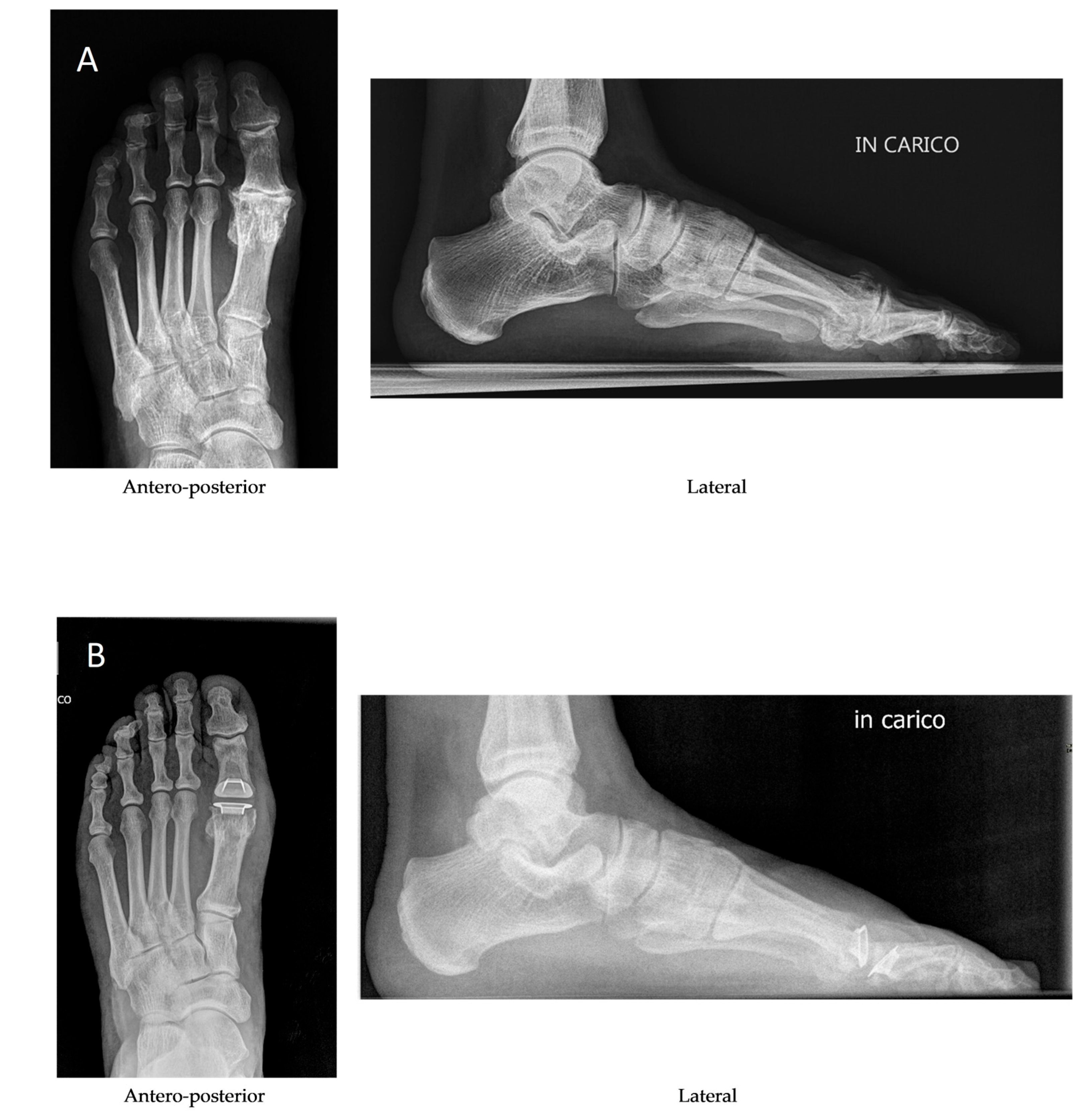 Diagnostics 15 01349 g004 Diagnostics 15 01349 g004