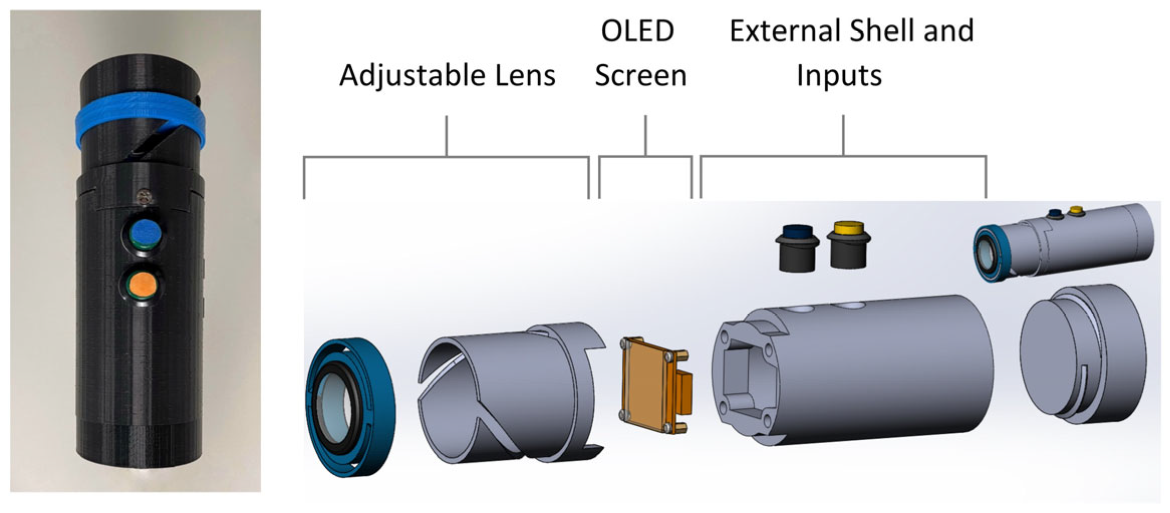 Diagnostics 15 01353 g001