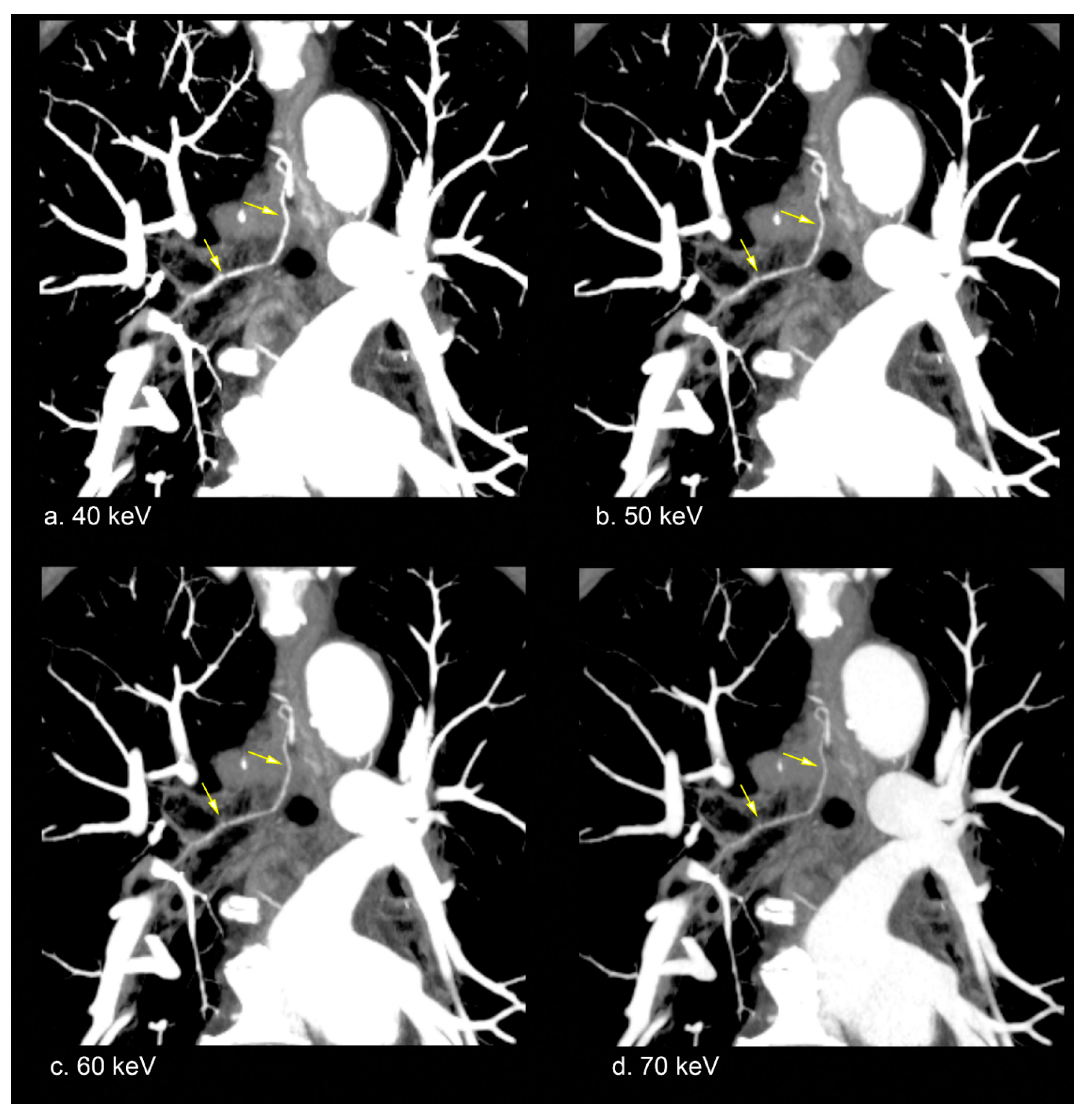Diagnostics 15 01354 g002