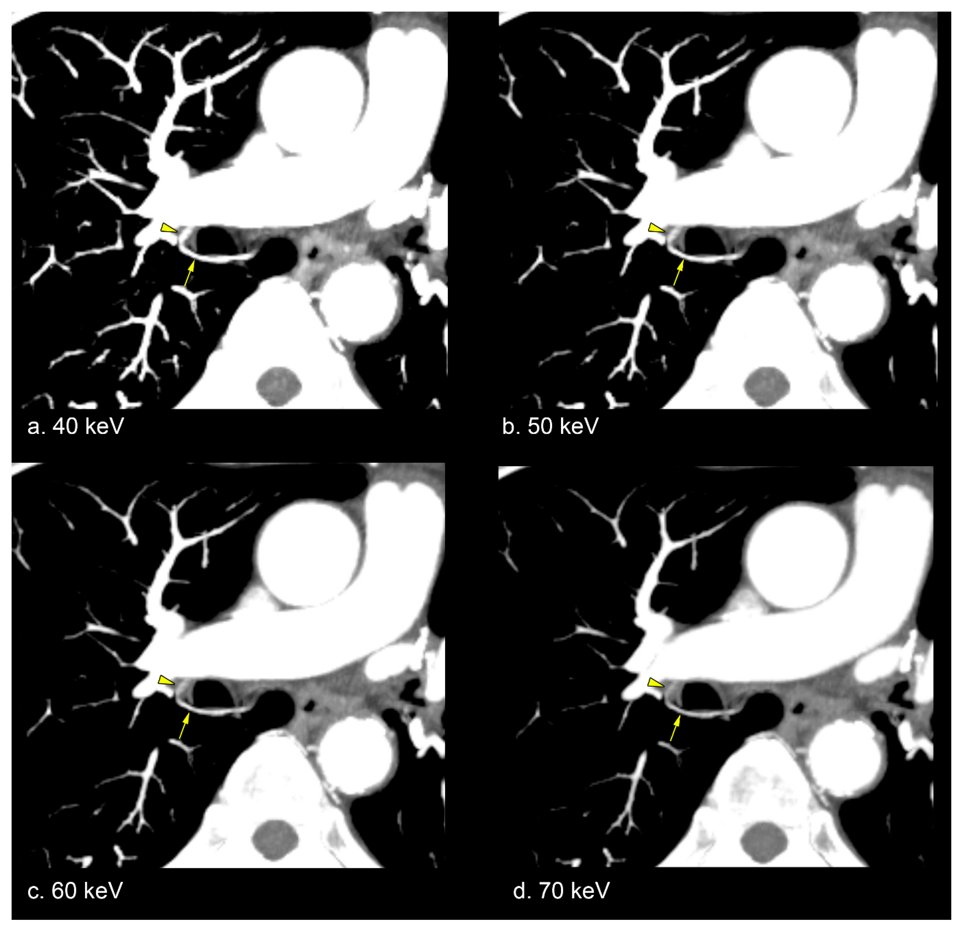 Diagnostics 15 01354 g003
