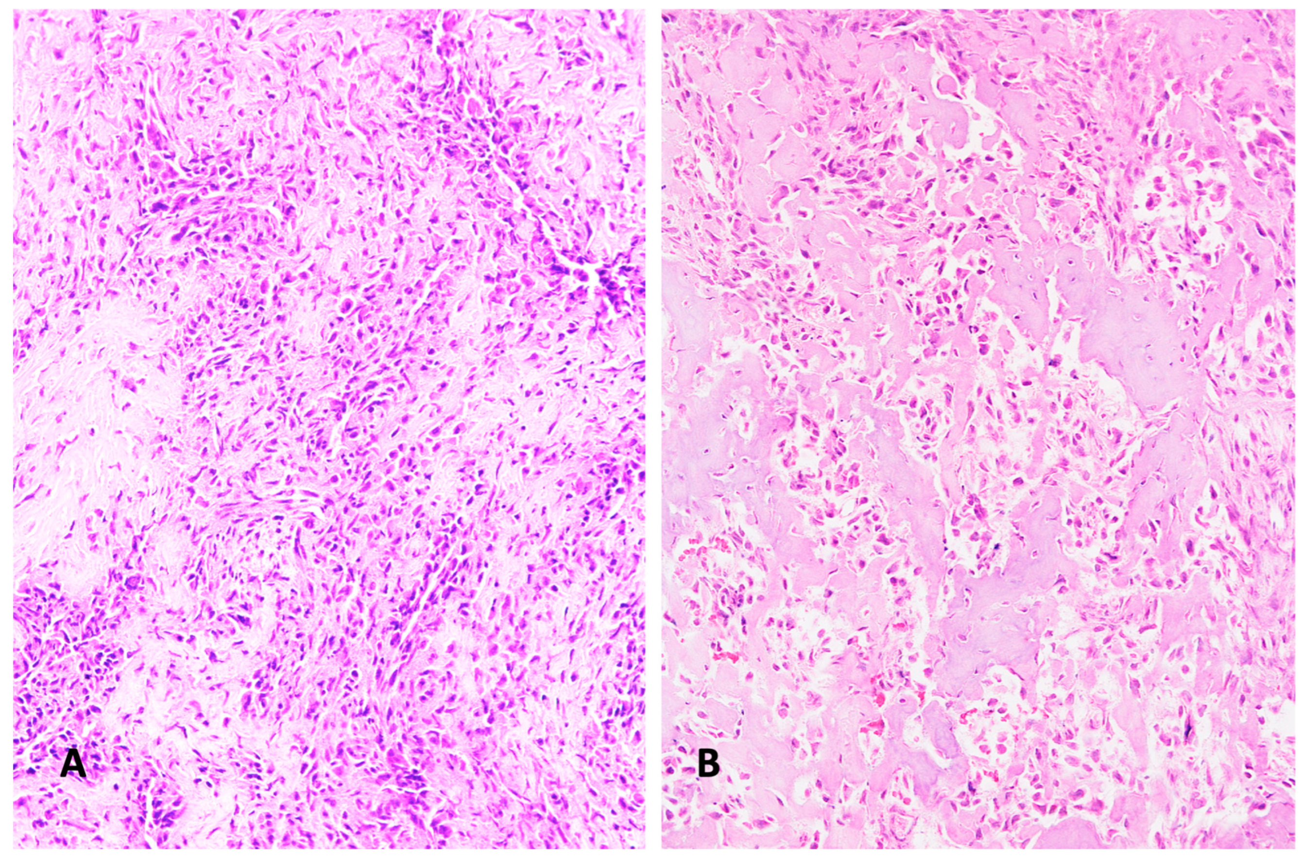 Diagnostics 15 01355 g004 Diagnostics 15 01355 g004