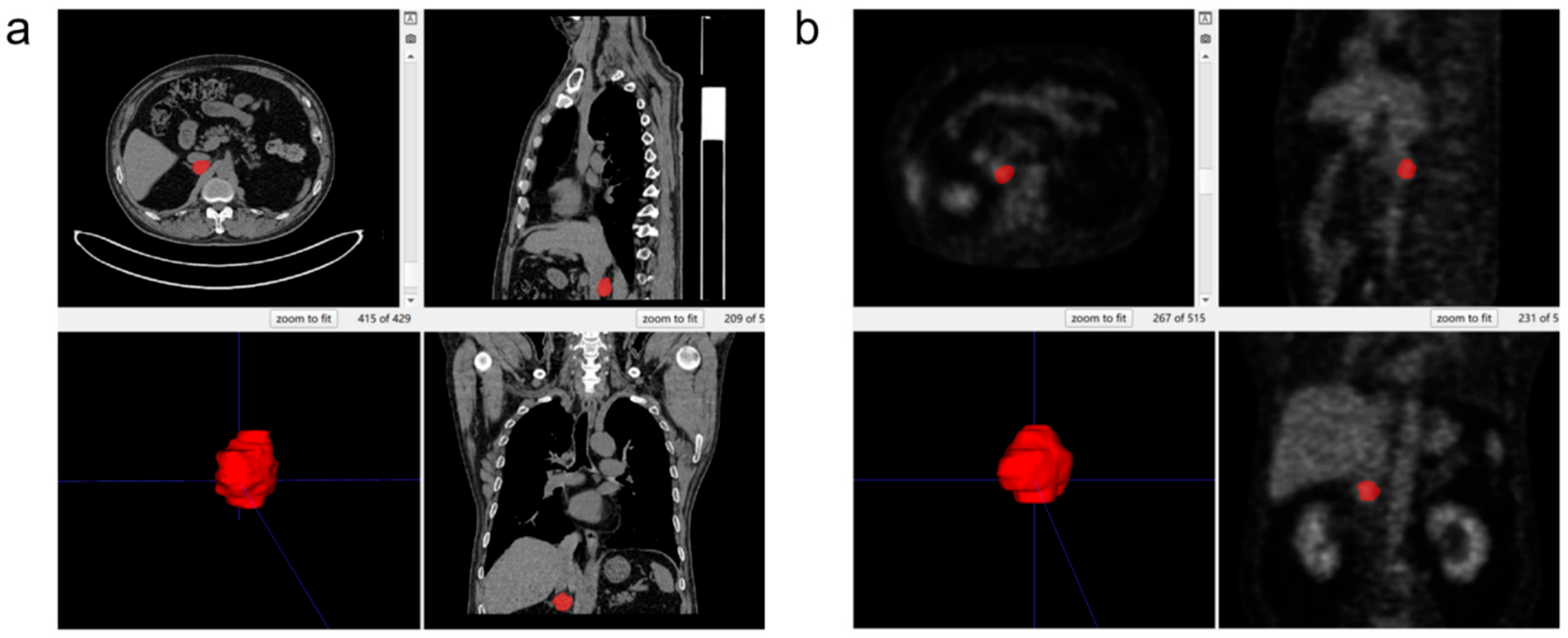 Diagnostics 15 01356 g003