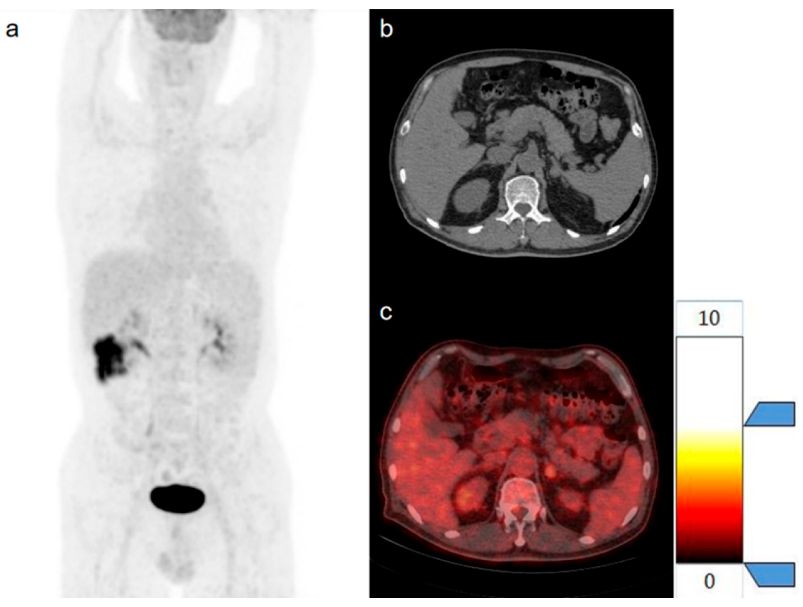 Diagnostics 15 01356 g007