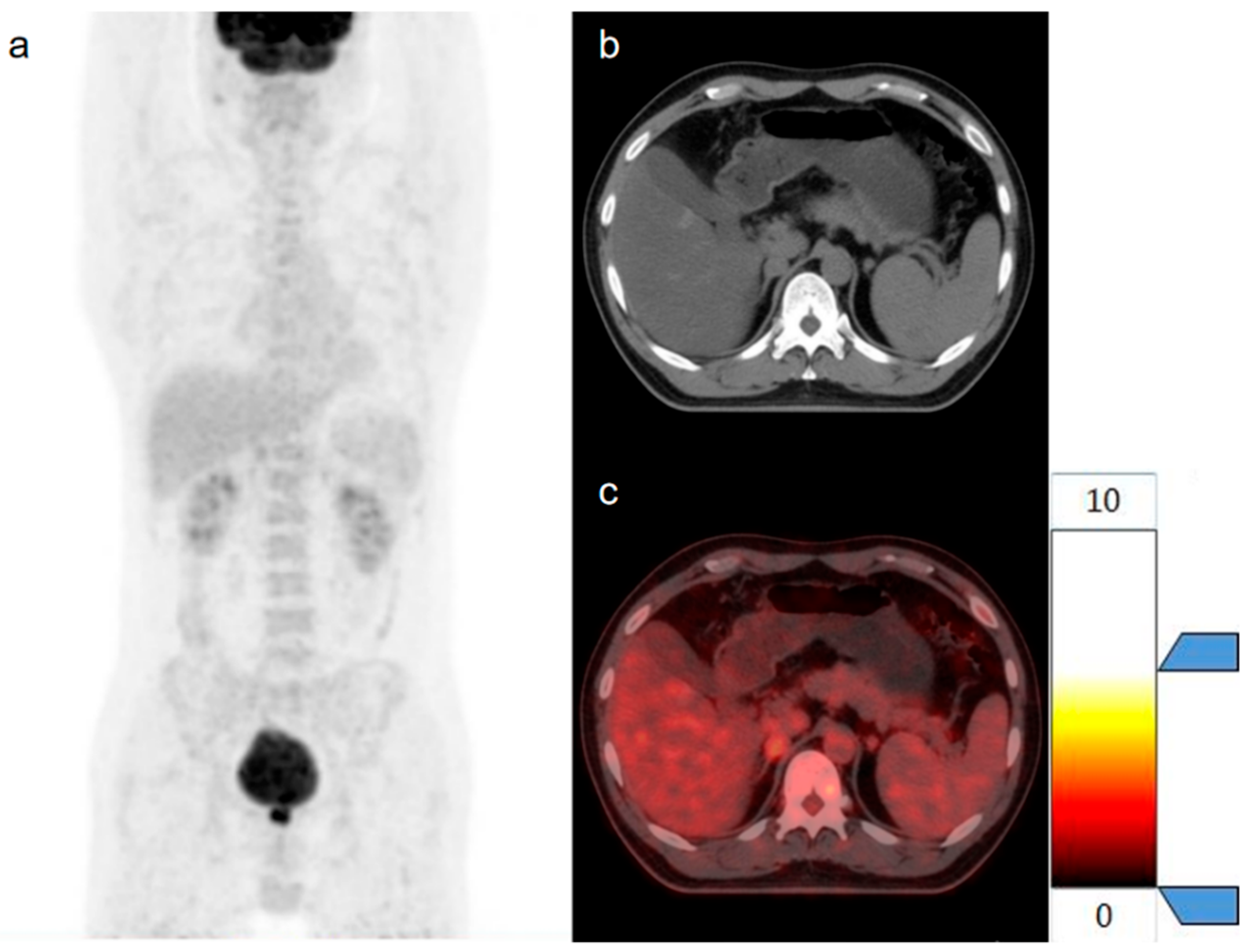 Diagnostics 15 01356 g008