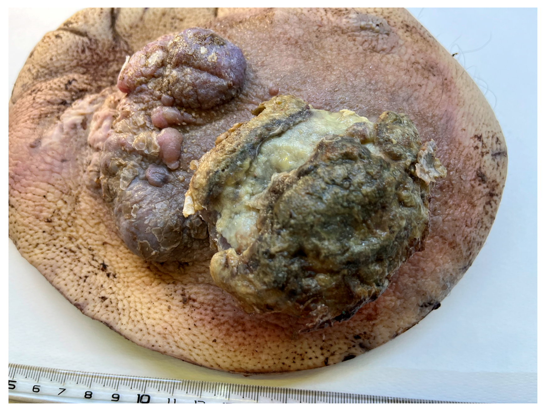 Diagnostics 15 01357 g001 Diagnostics 15 01357 g001