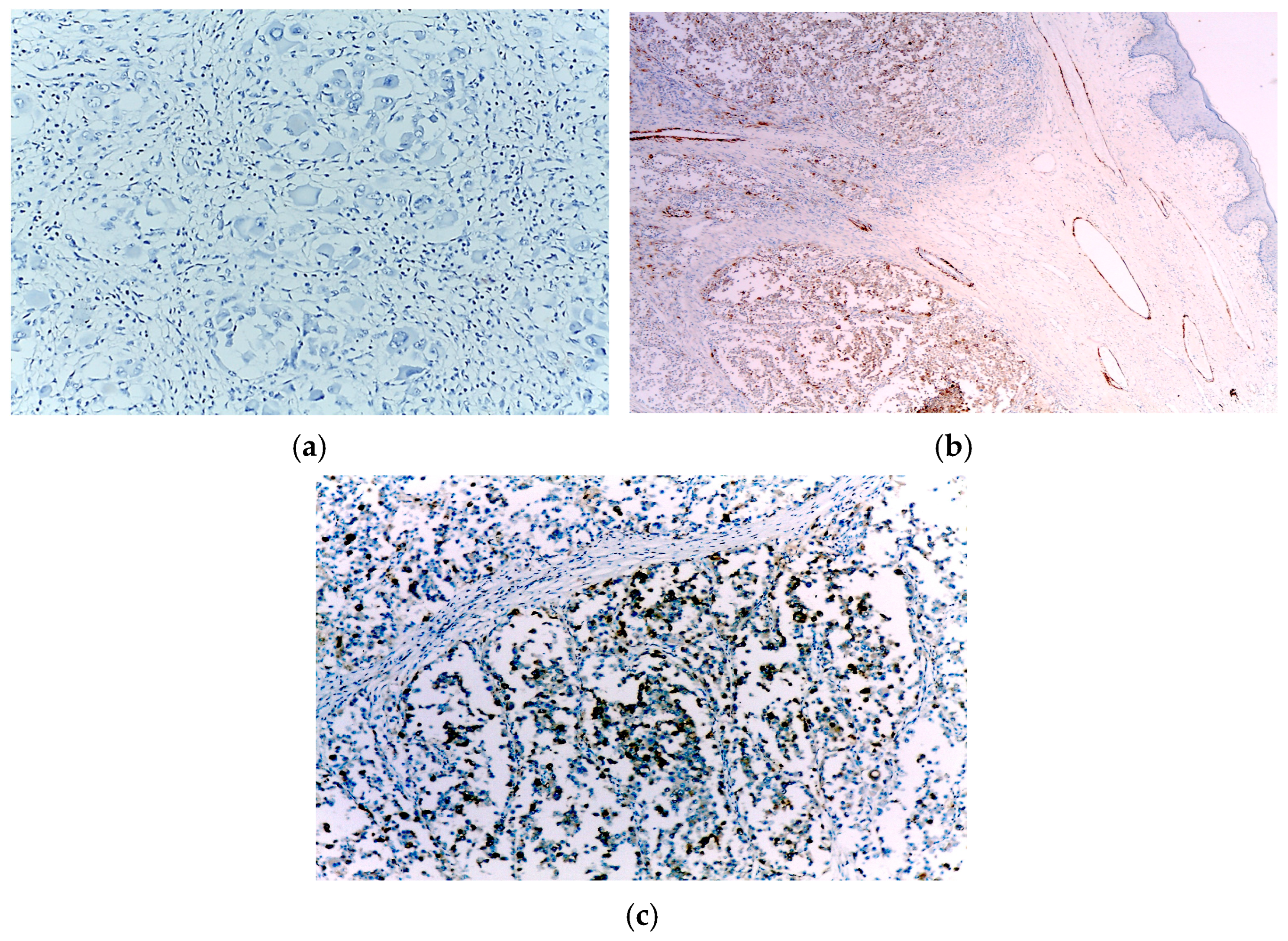 Diagnostics 15 01357 g004 Diagnostics 15 01357 g004