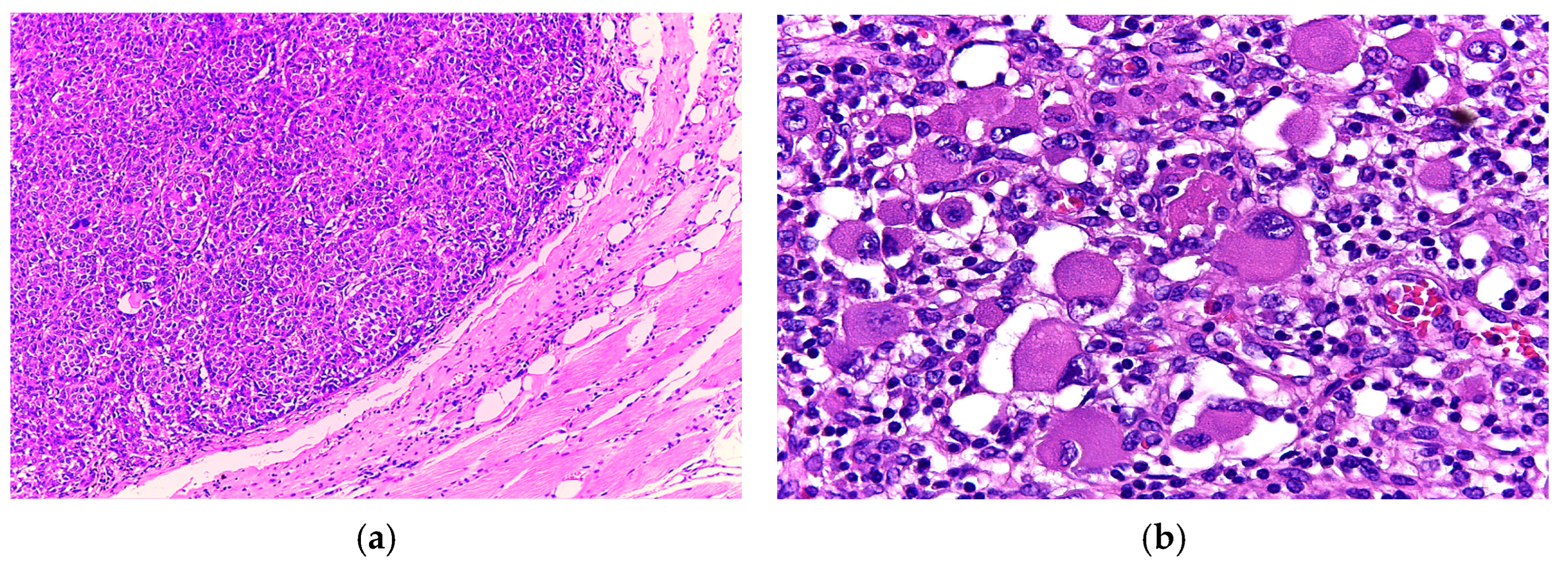 Diagnostics 15 01357 g006 Diagnostics 15 01357 g006