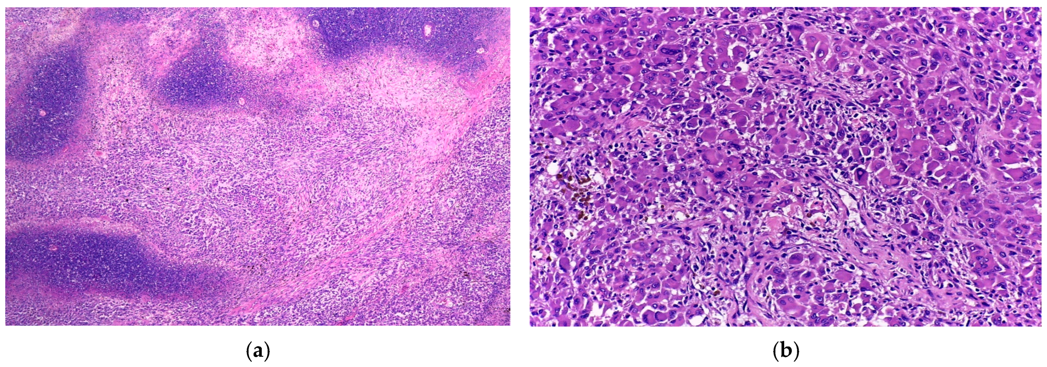 Diagnostics 15 01357 g007 Diagnostics 15 01357 g007