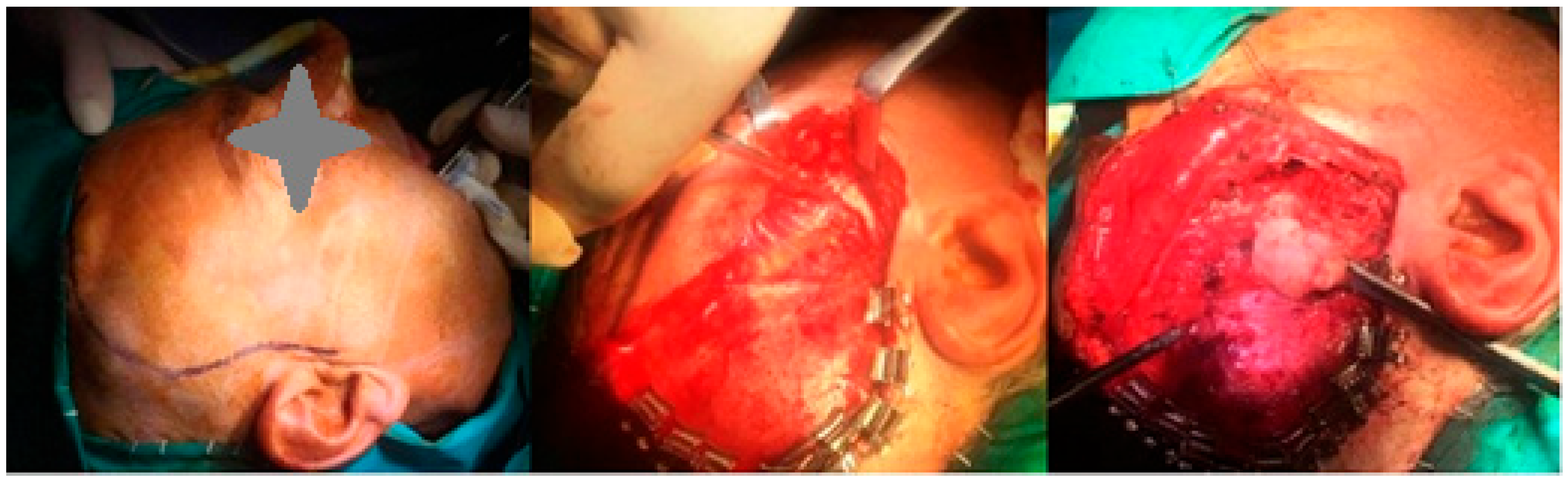 Diagnostics 15 01360 g002