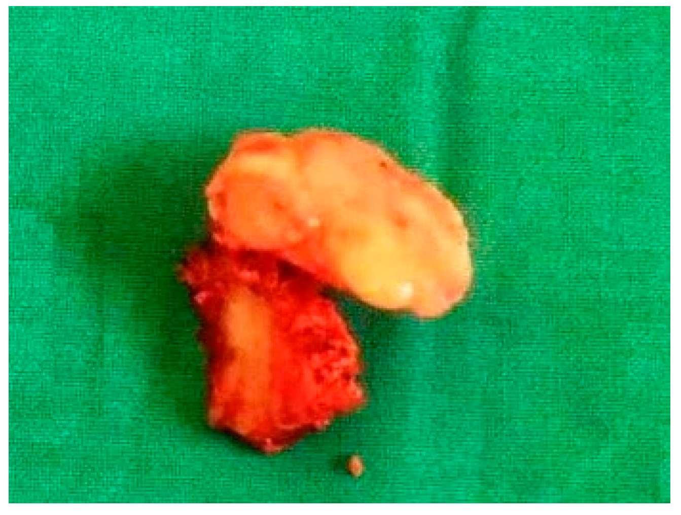 Diagnostics 15 01360 g003