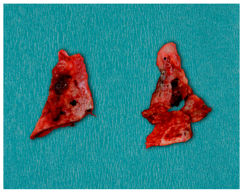 Diagnostics 15 01360 g007