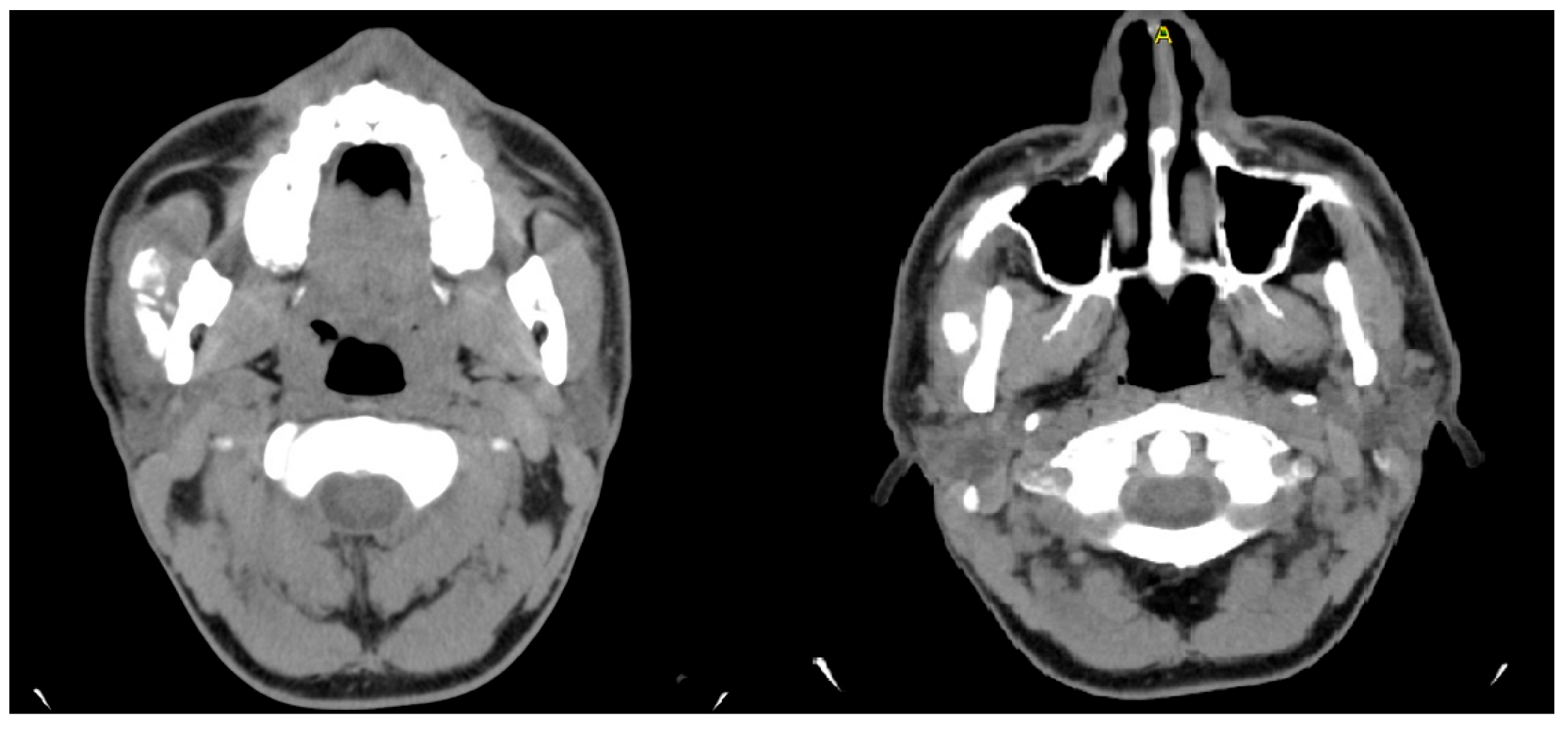 Diagnostics 15 01360 g009