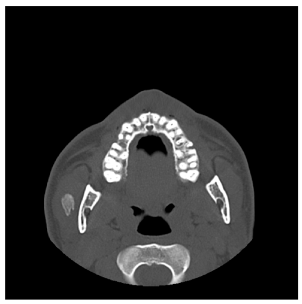 Diagnostics 15 01360 g010