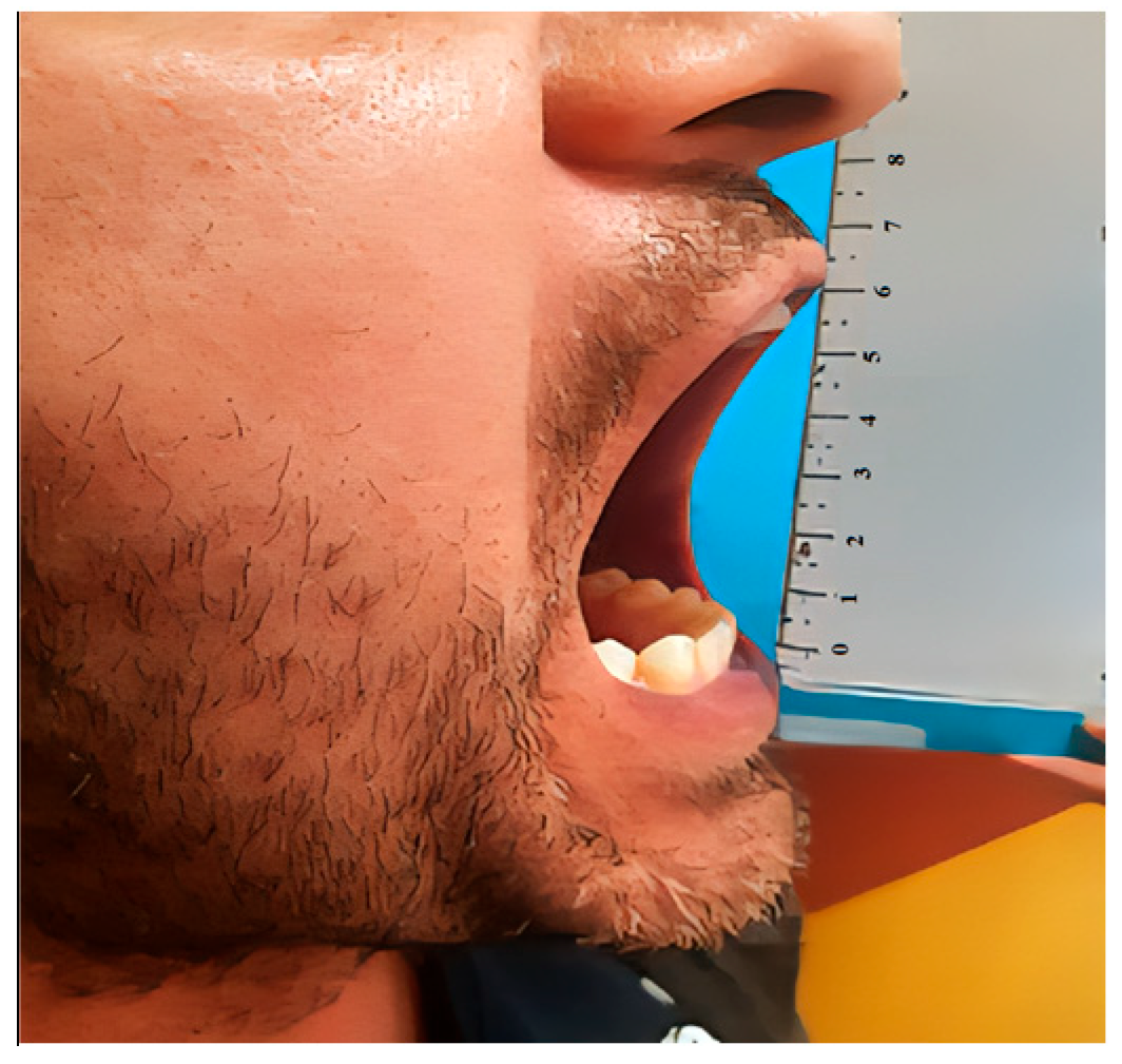 Diagnostics 15 01360 g011