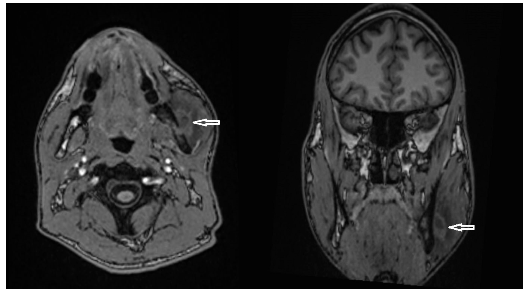 Diagnostics 15 01360 g013