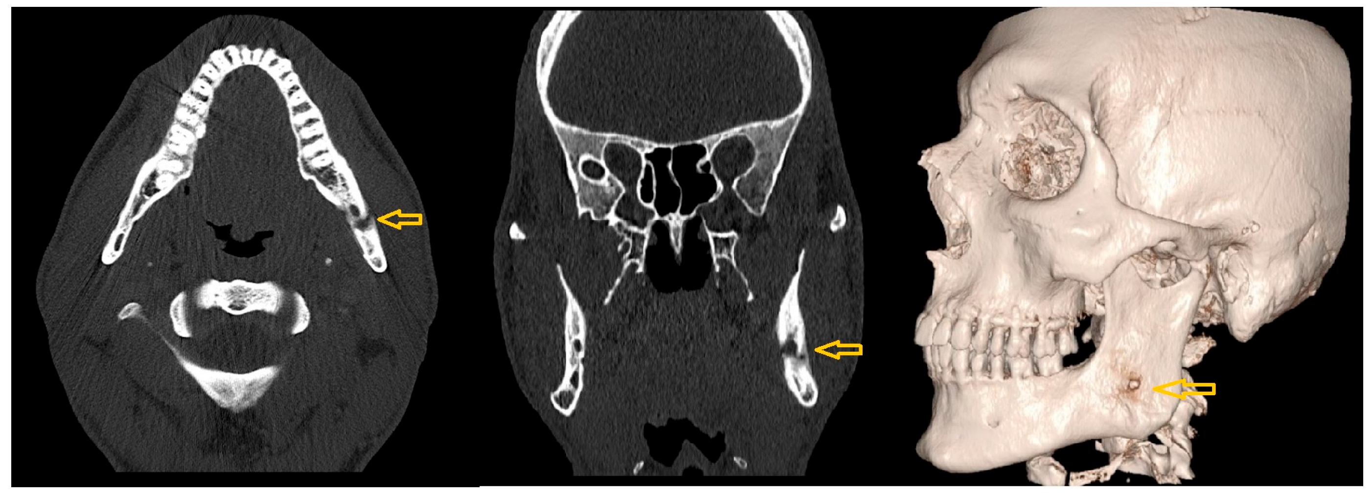 Diagnostics 15 01360 g014