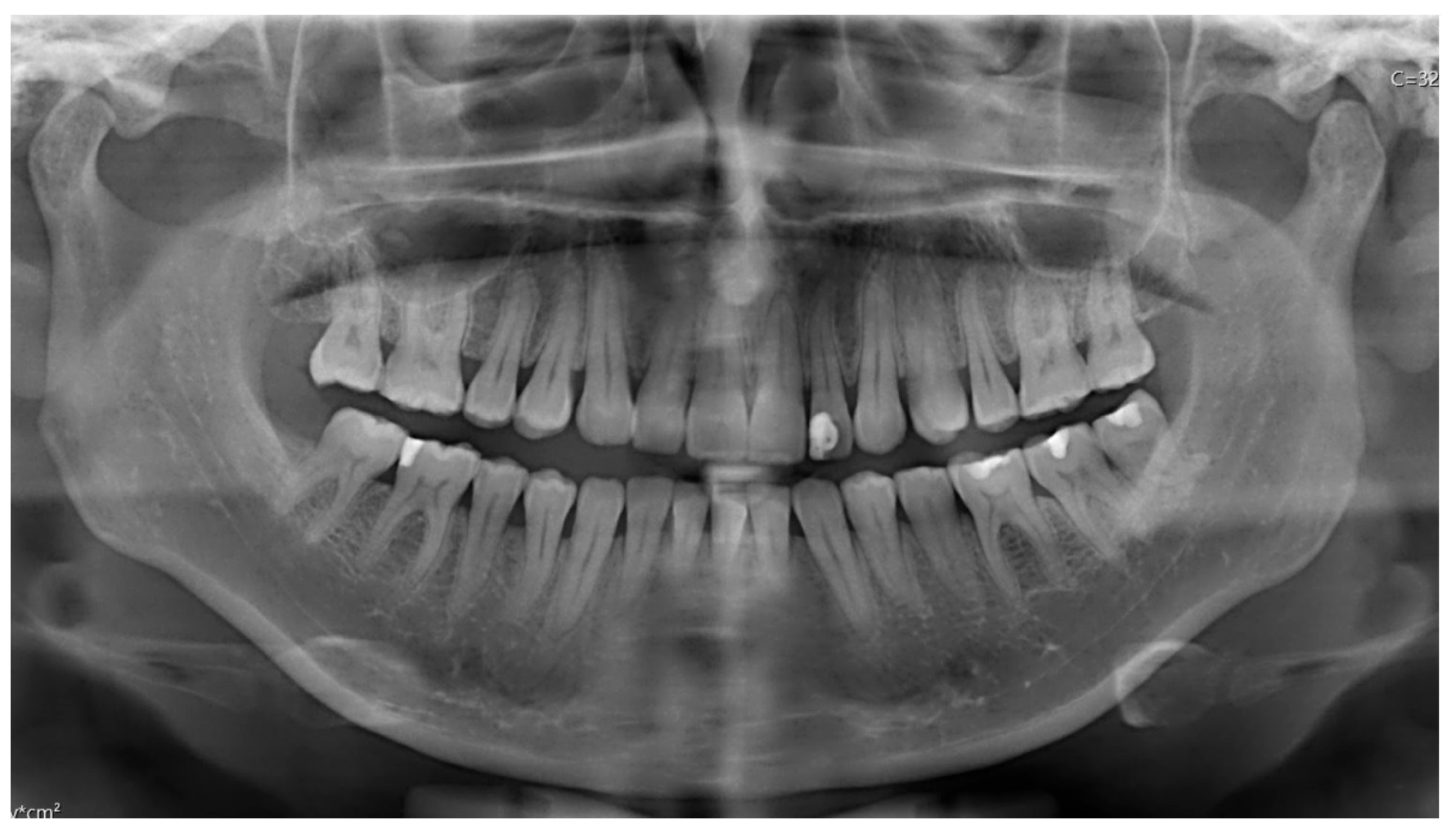 Diagnostics 15 01360 g015