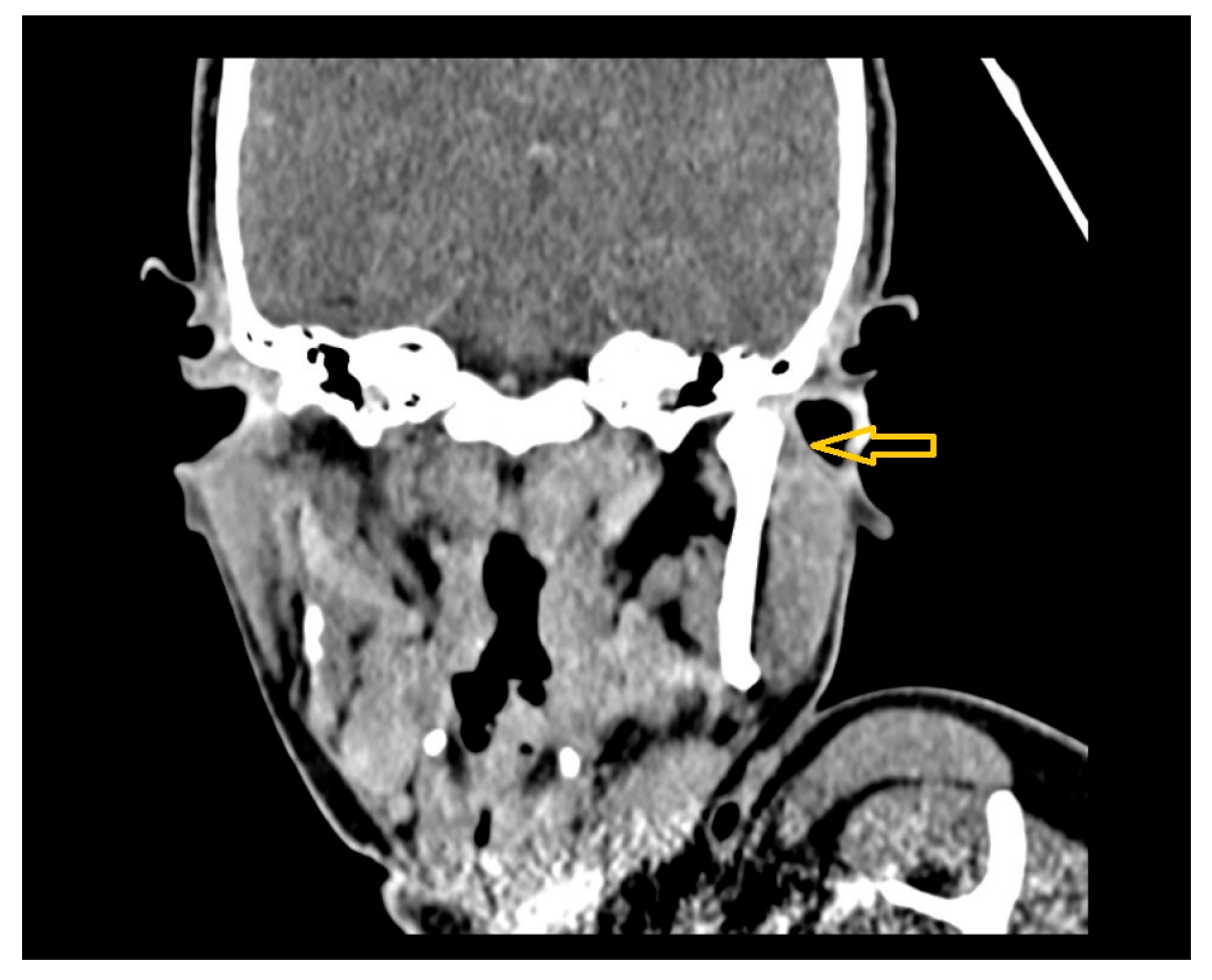 Diagnostics 15 01360 g016