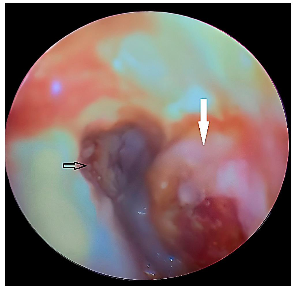 Diagnostics 15 01360 g018