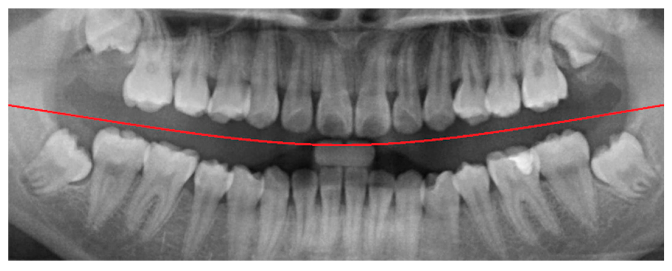 Diagnostics 15 01363 g004