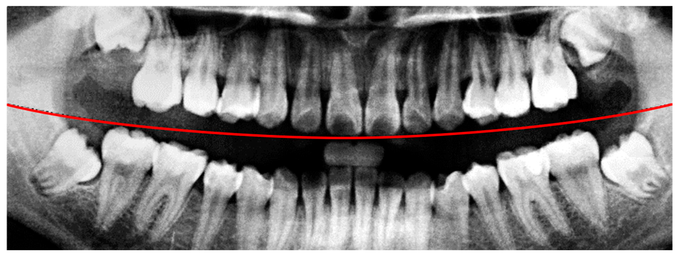 Diagnostics 15 01363 g005