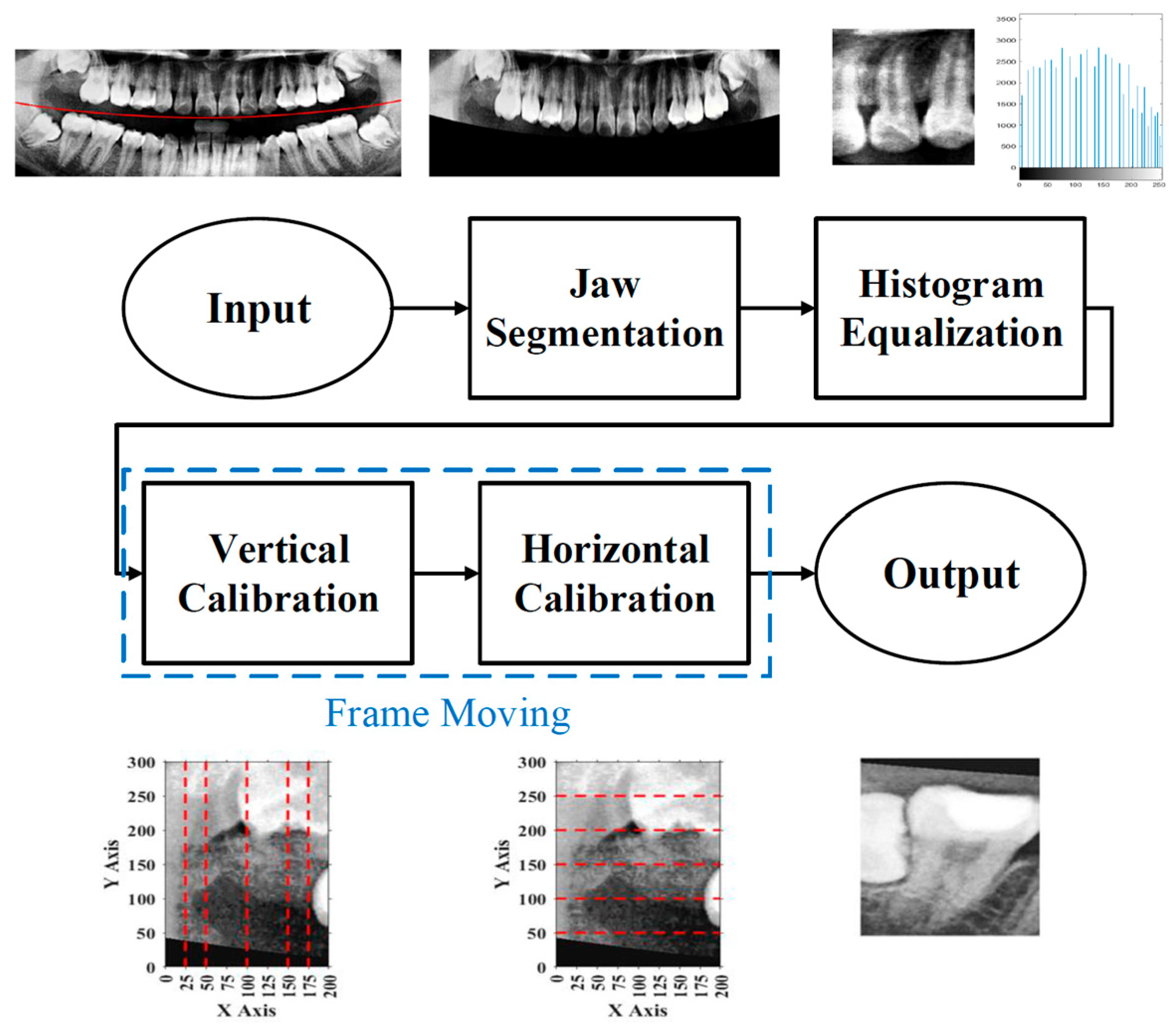 Diagnostics 15 01363 g006