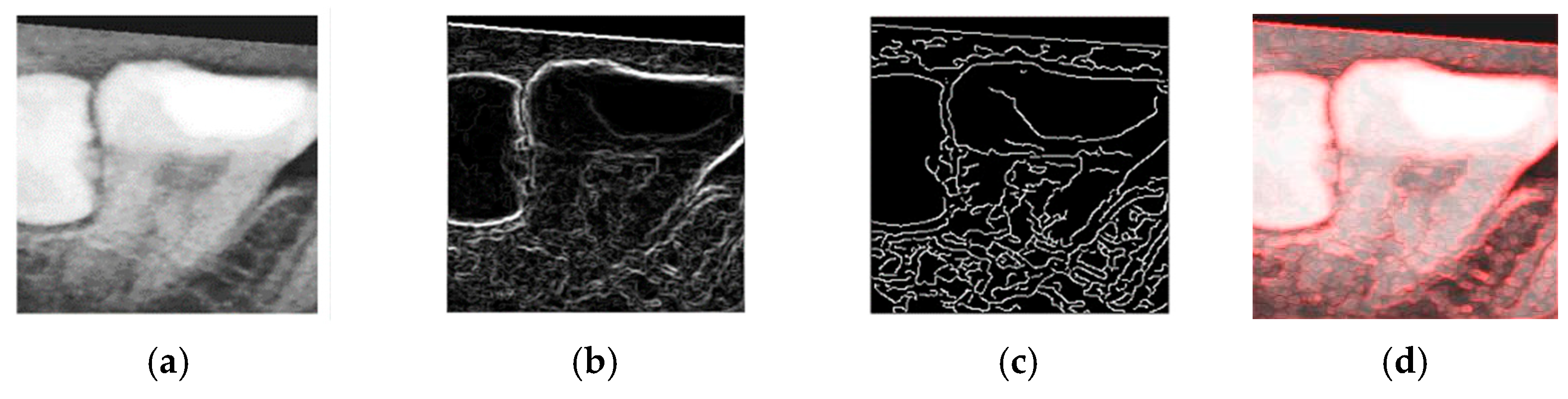 Diagnostics 15 01363 g012