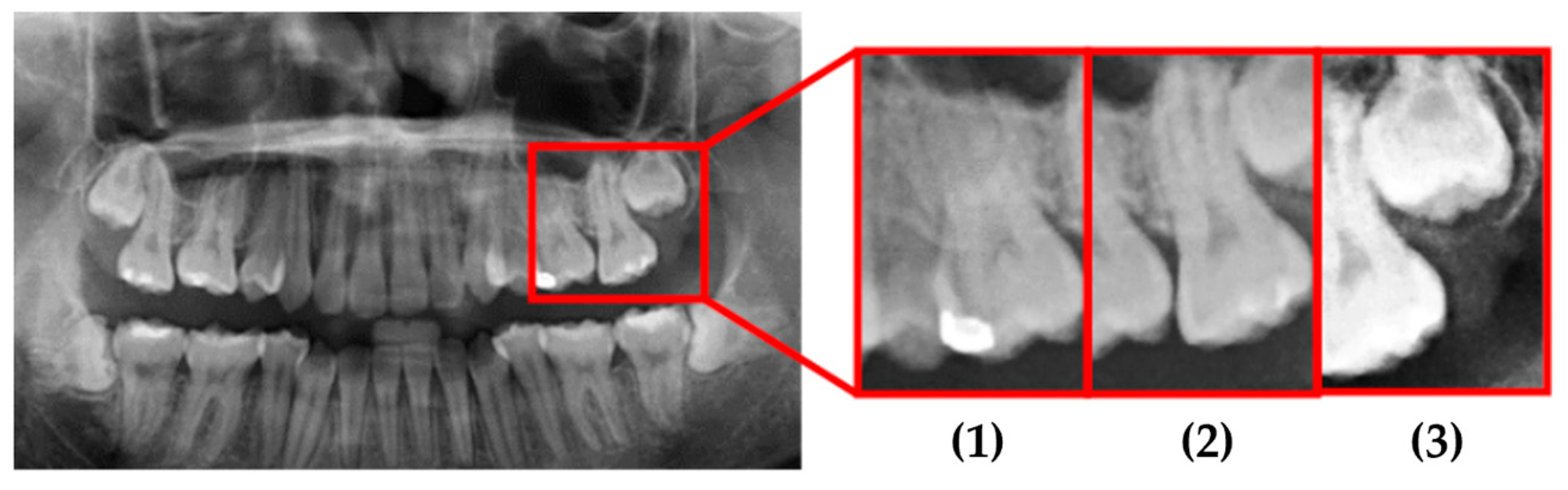 Diagnostics 15 01363 g017
