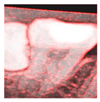 Diagnostics 15 01363 i002