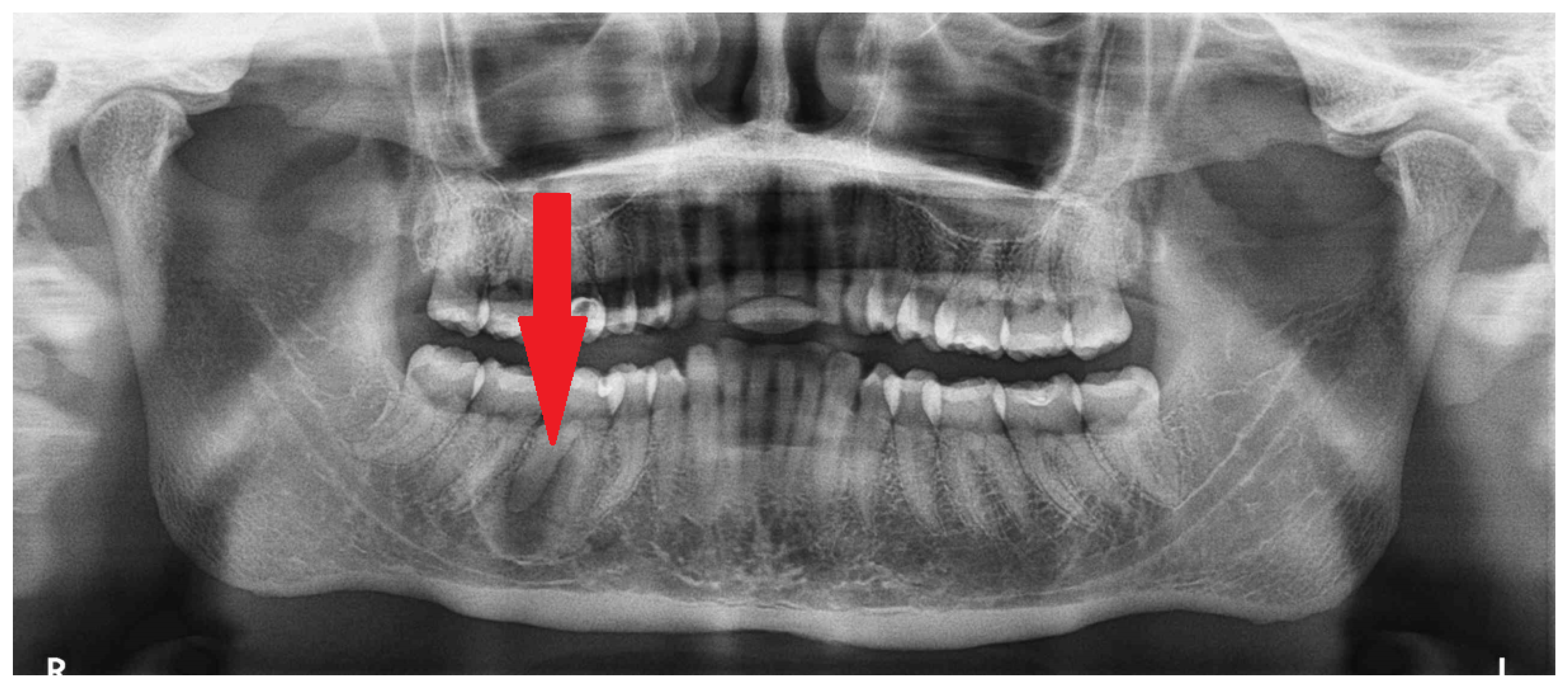 Diagnostics 15 01367 g001