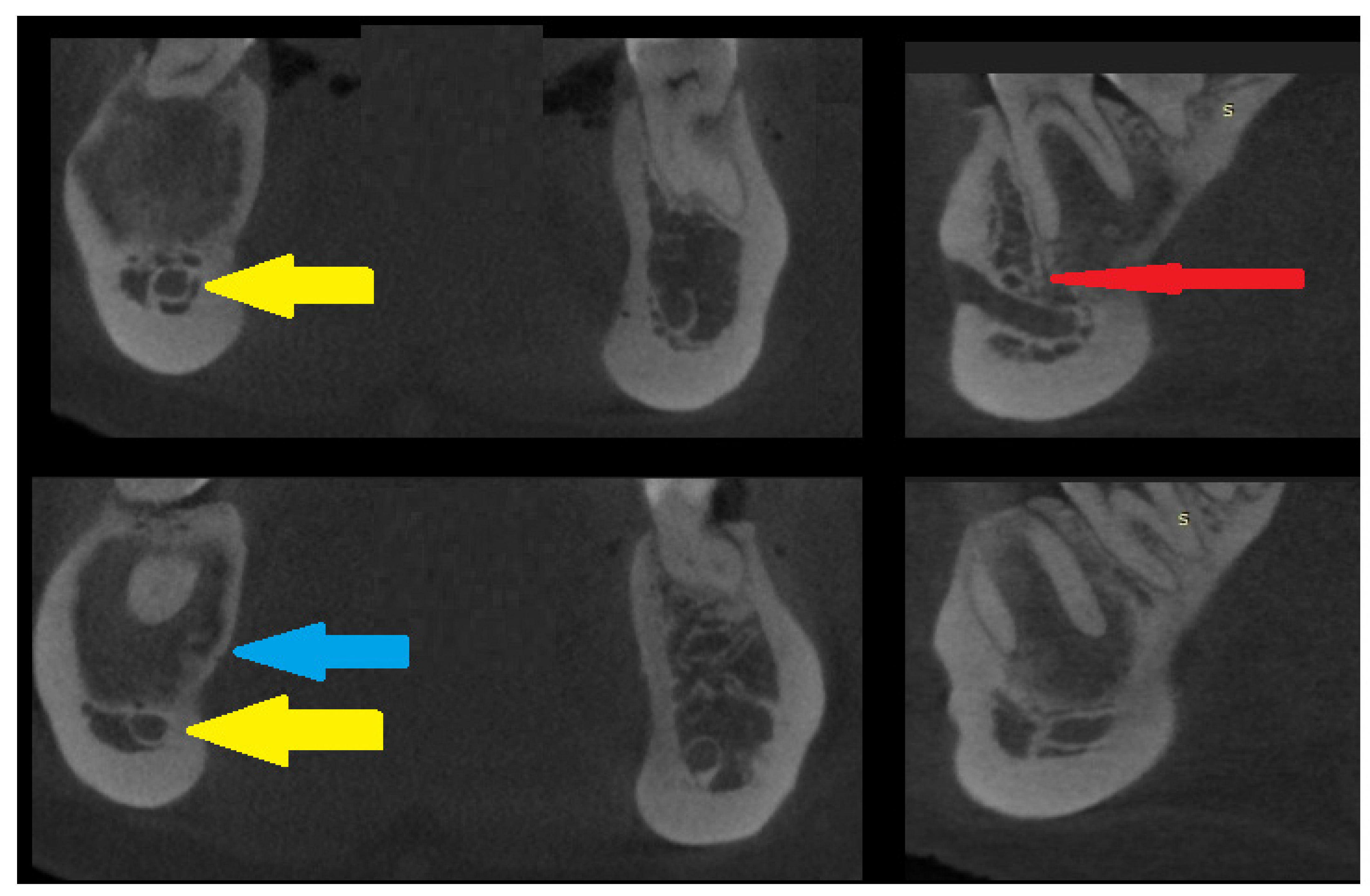Diagnostics 15 01367 g003